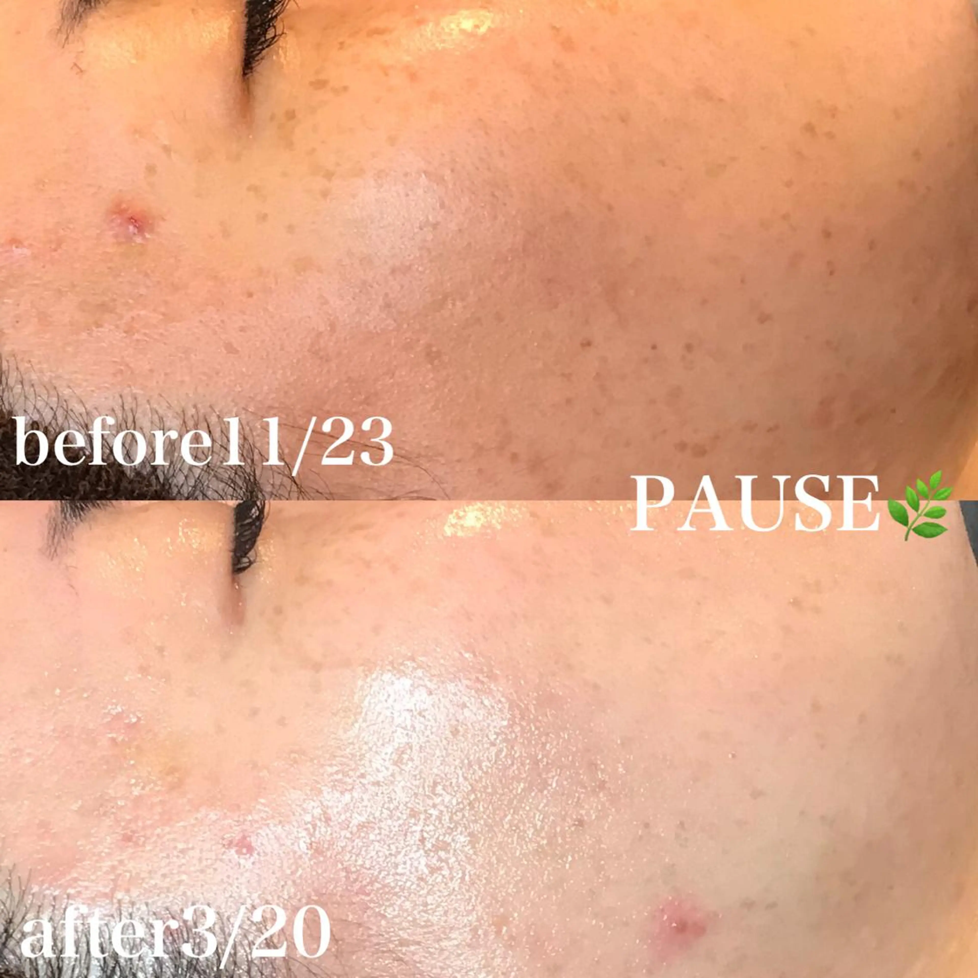 エステ 浜野 恵美のエステ・リラクイメージ