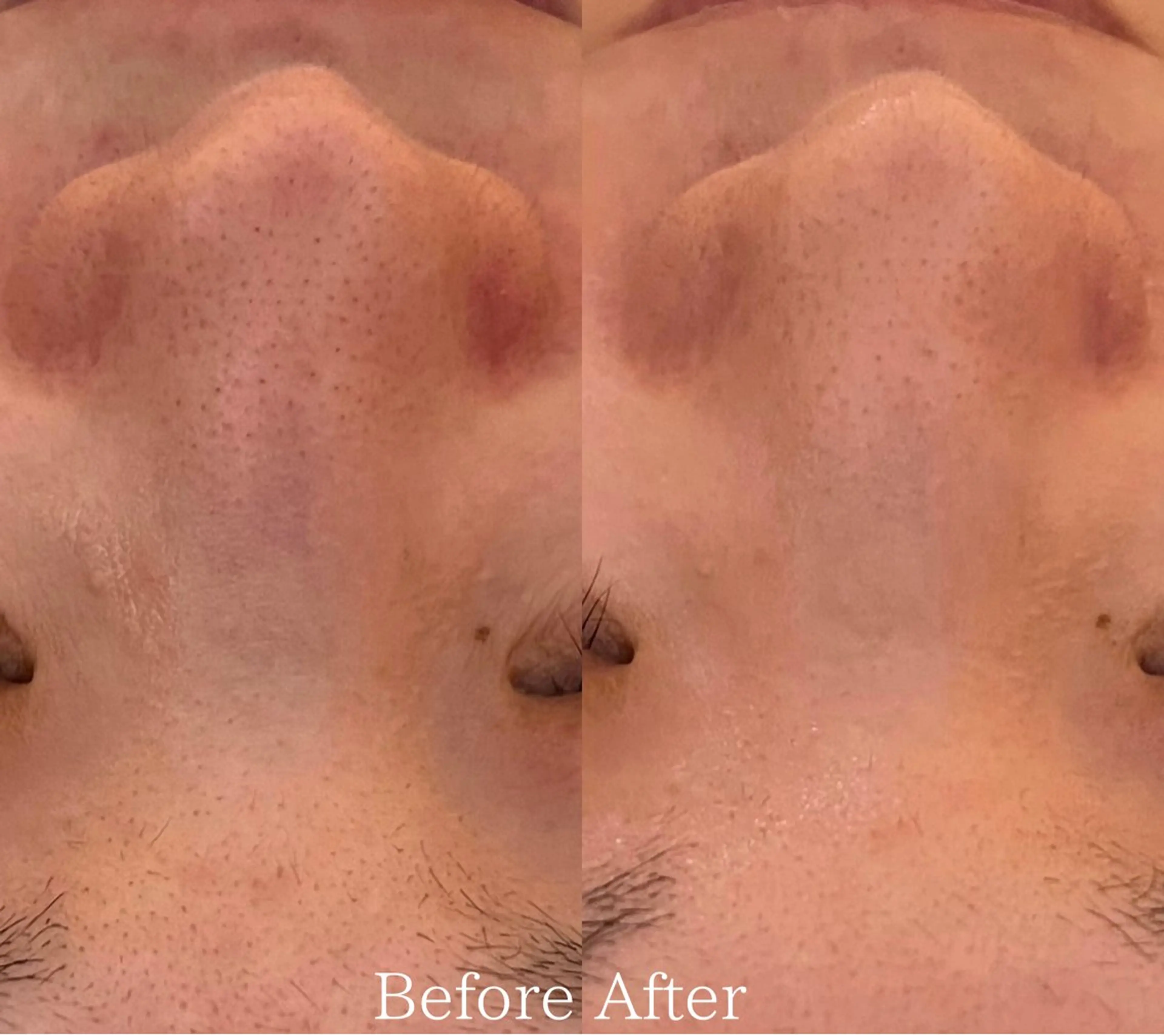 エステ リラク デアイム東広島所属・中井 小春のエステ・リラクイメージ