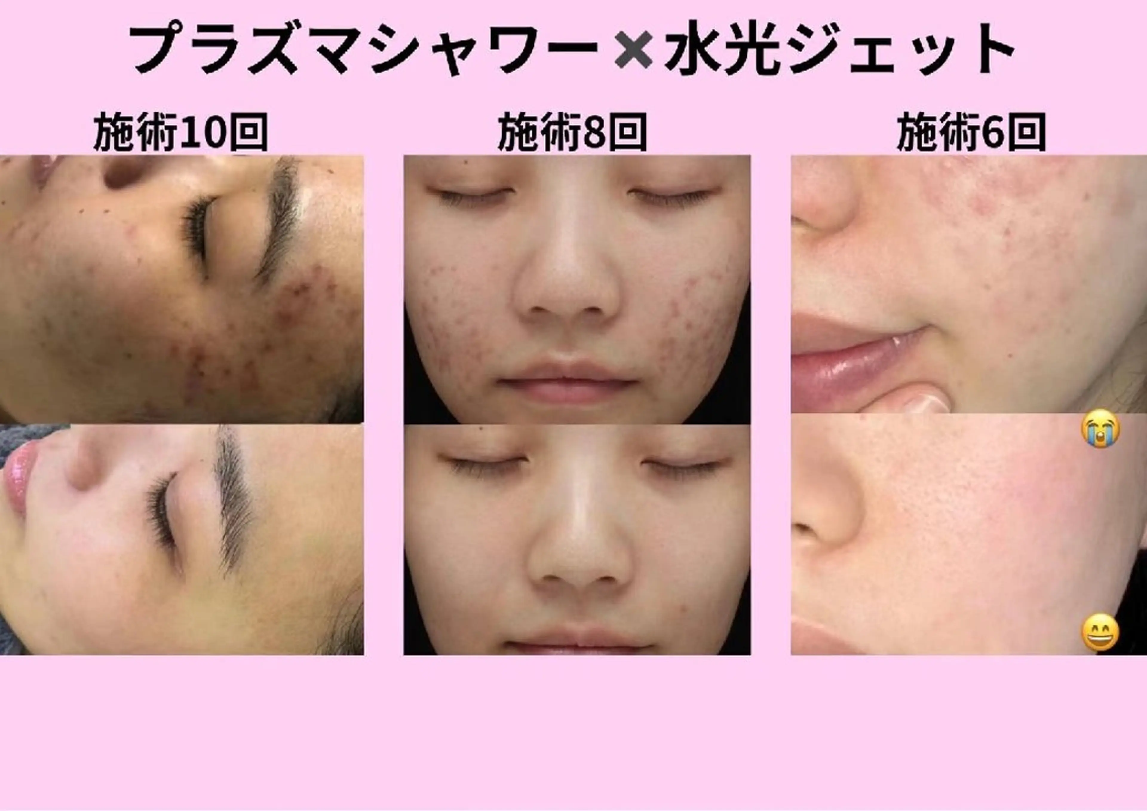 マツエク・マツパ 結婚式・ブライダル aliaハイフ&水光ジェットサロン所属・aliaハーブ水光店 エステティシャン募集のエステ・リラクイメージ