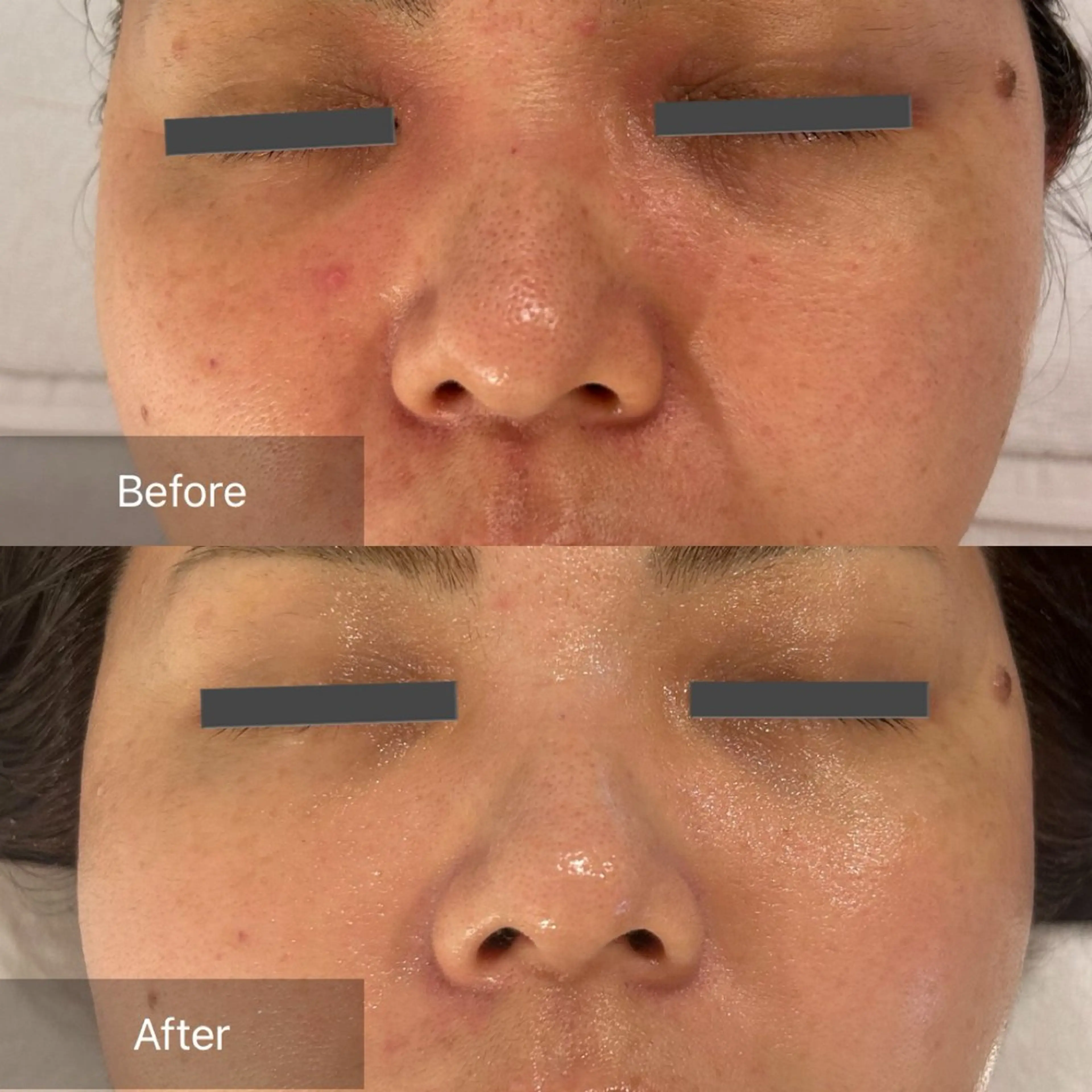 「敏感肌・赤み・炎症でお悩みはこれ！」【SEN管理】の写真