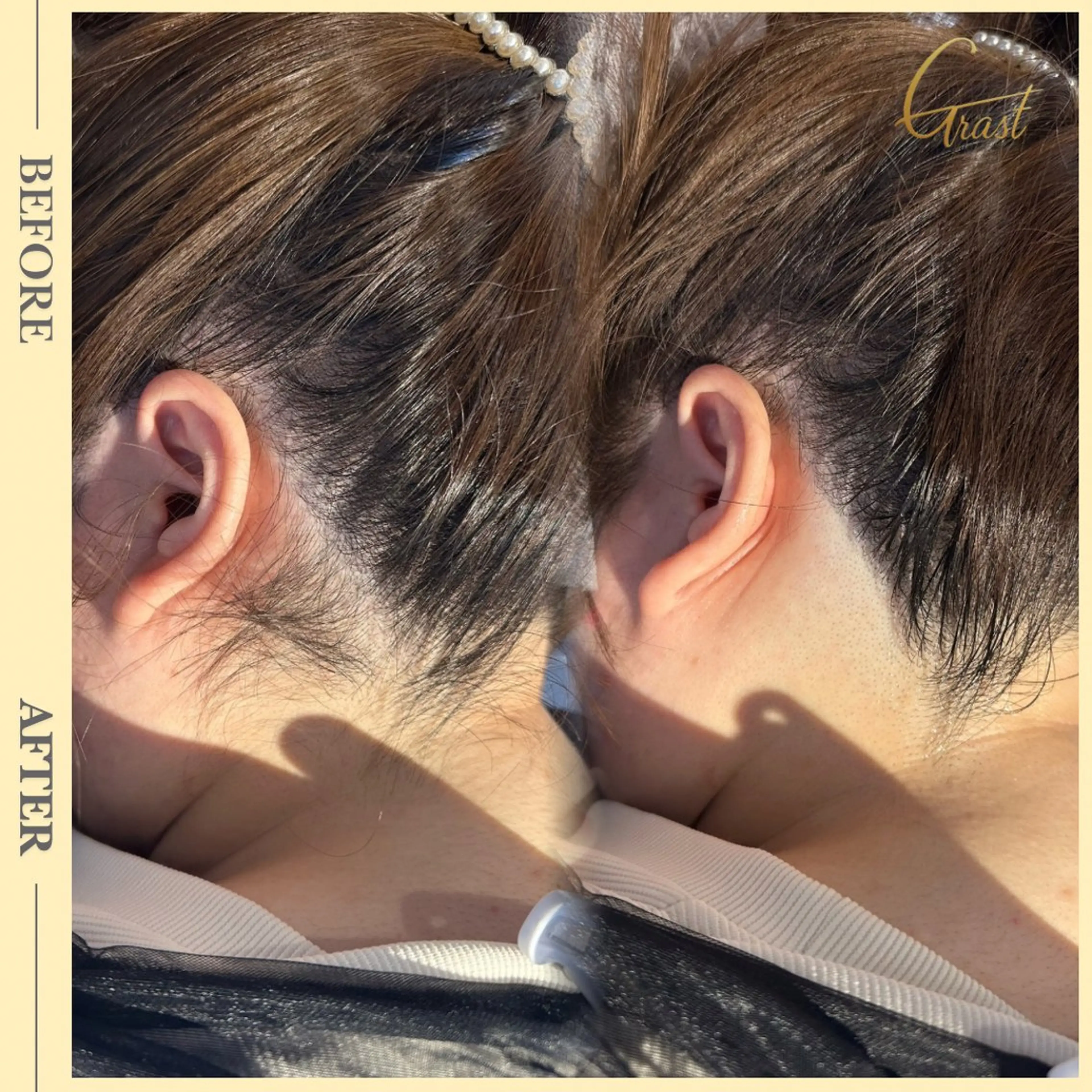 ツヤ肌脱毛サロン Grast🌿アイカのエステ・リラクイメージ