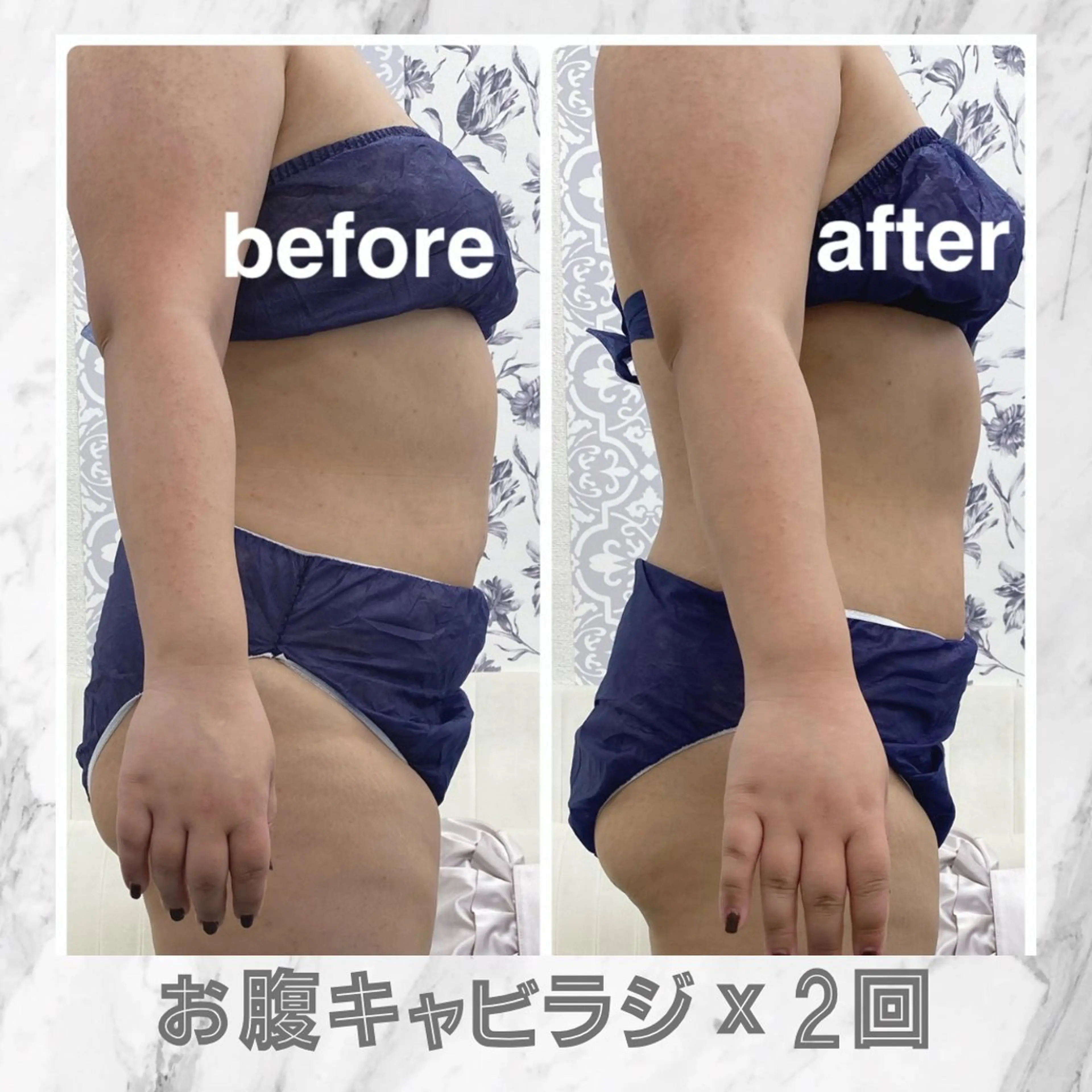 小顔痩身HALO 二宮早織のエステ・リラクイメージ