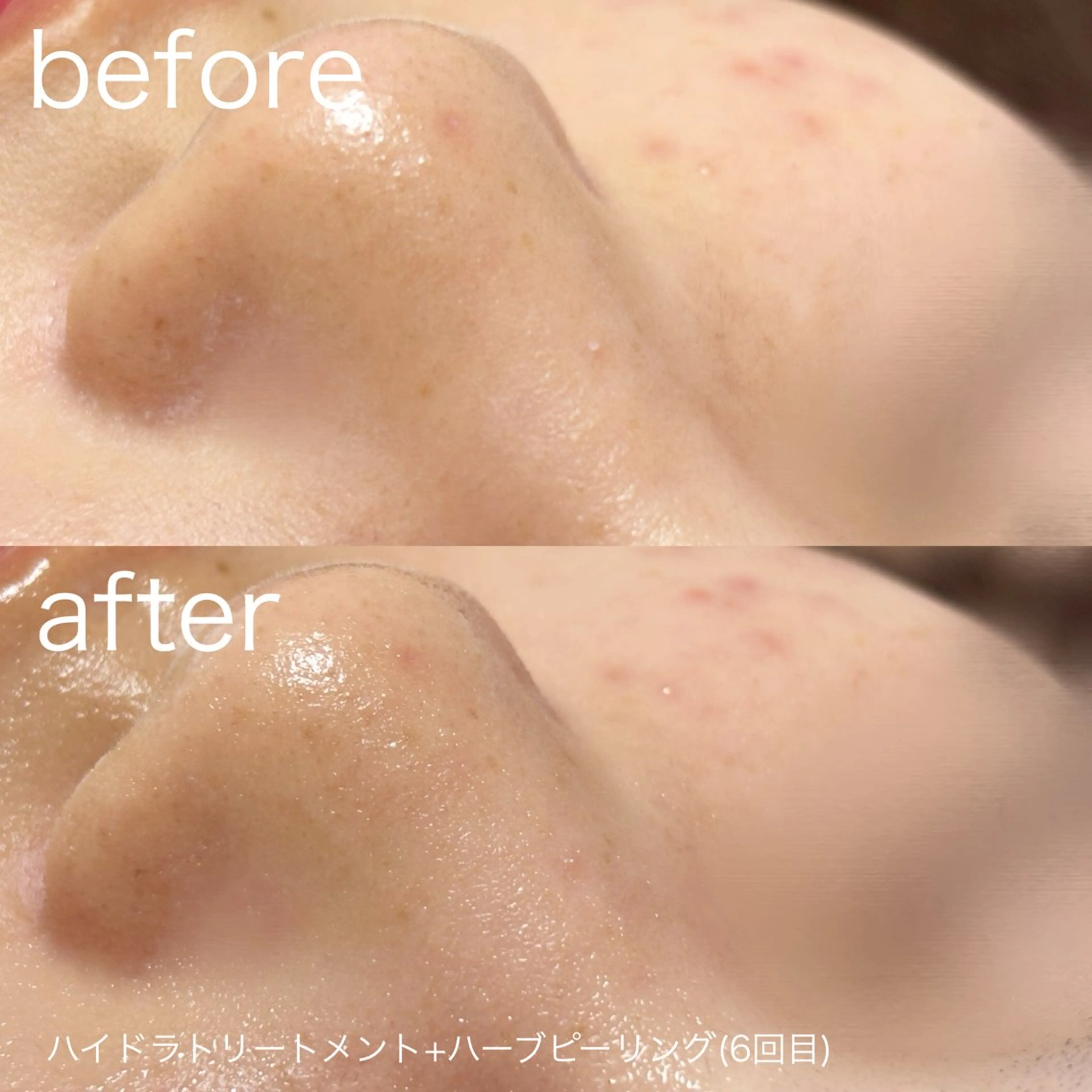 その他 lulularico Yuのエステ・リラクイメージ