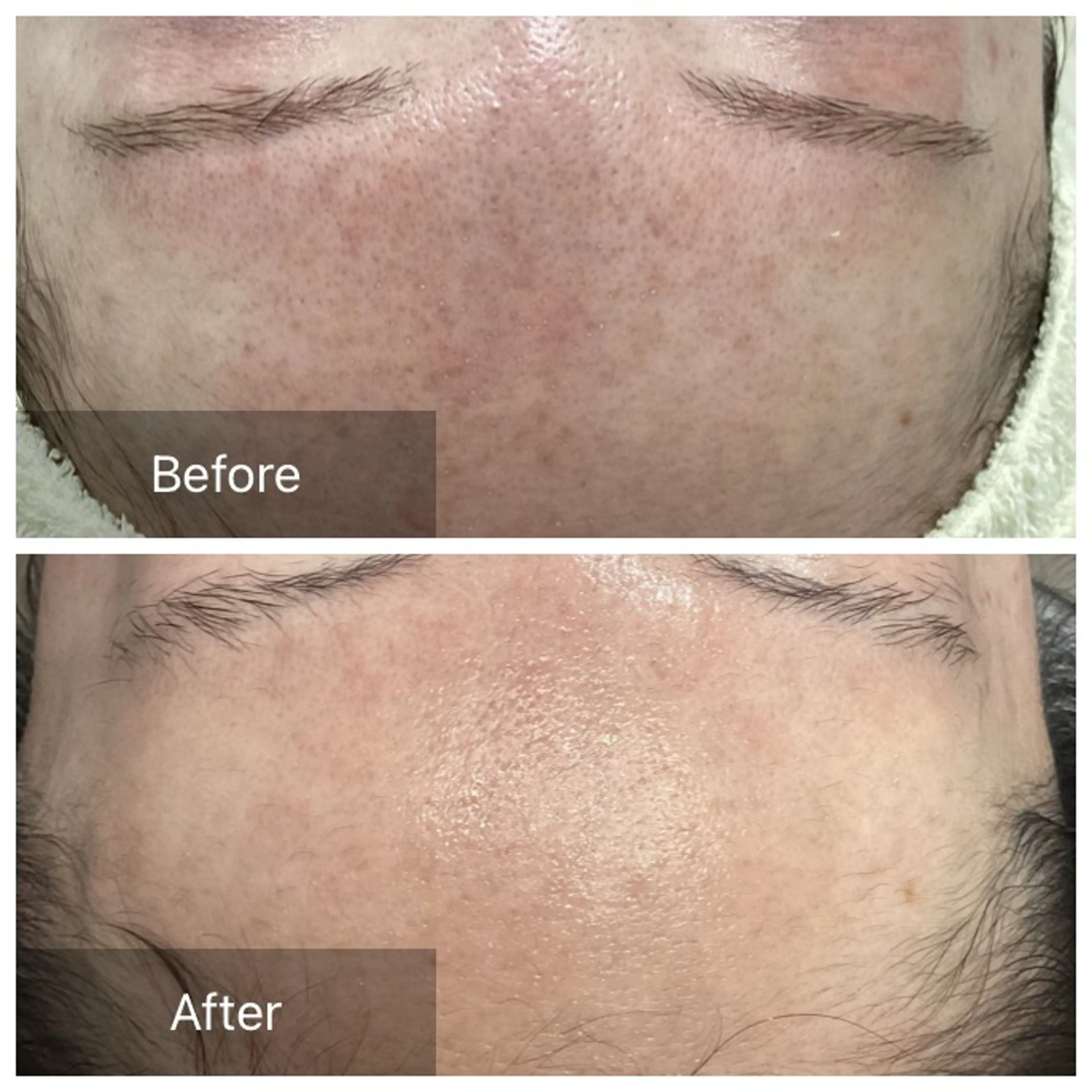 エステ Dahlia Moriのエステ・リラクイメージ