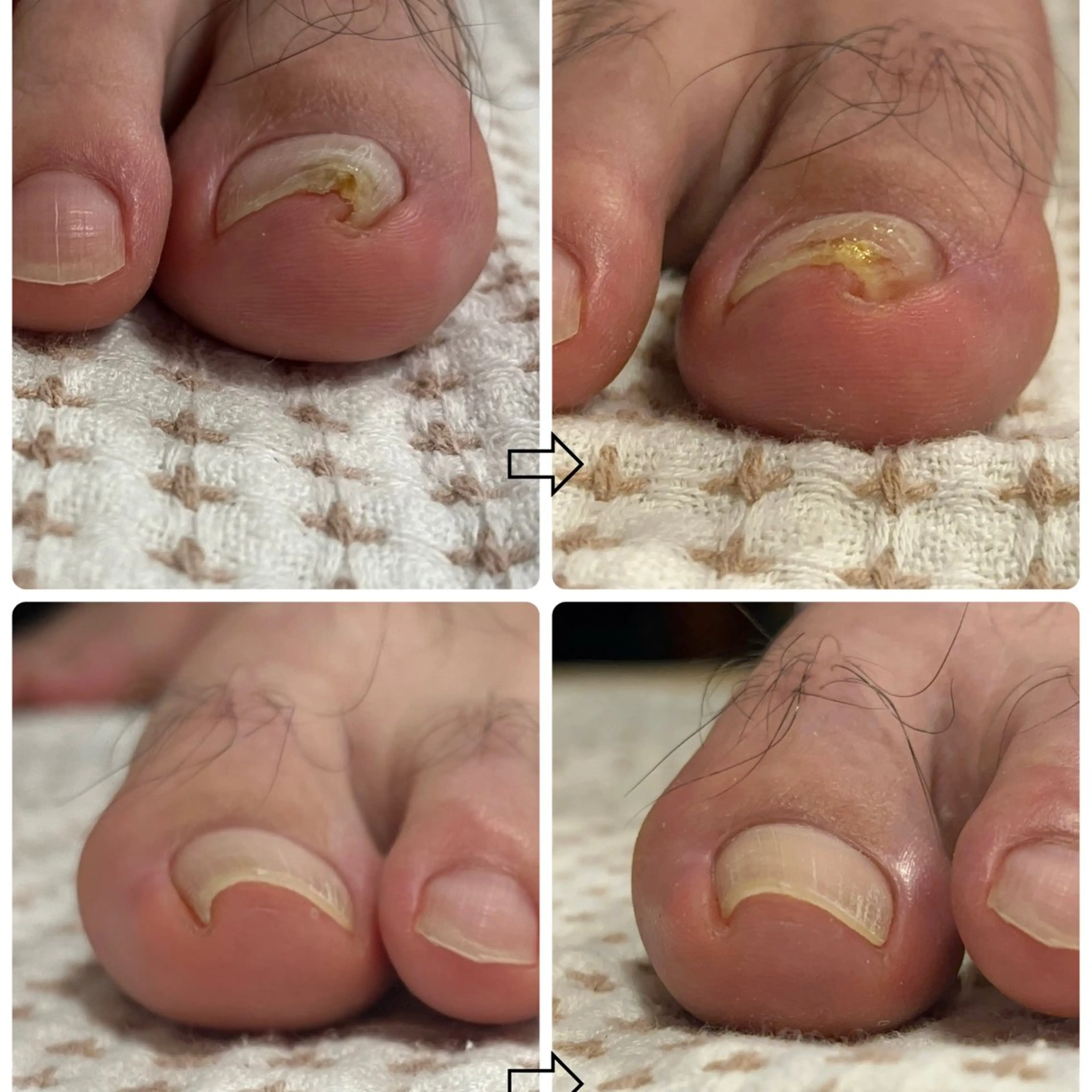 ネイル LUnails MAHOのネイルデザイン