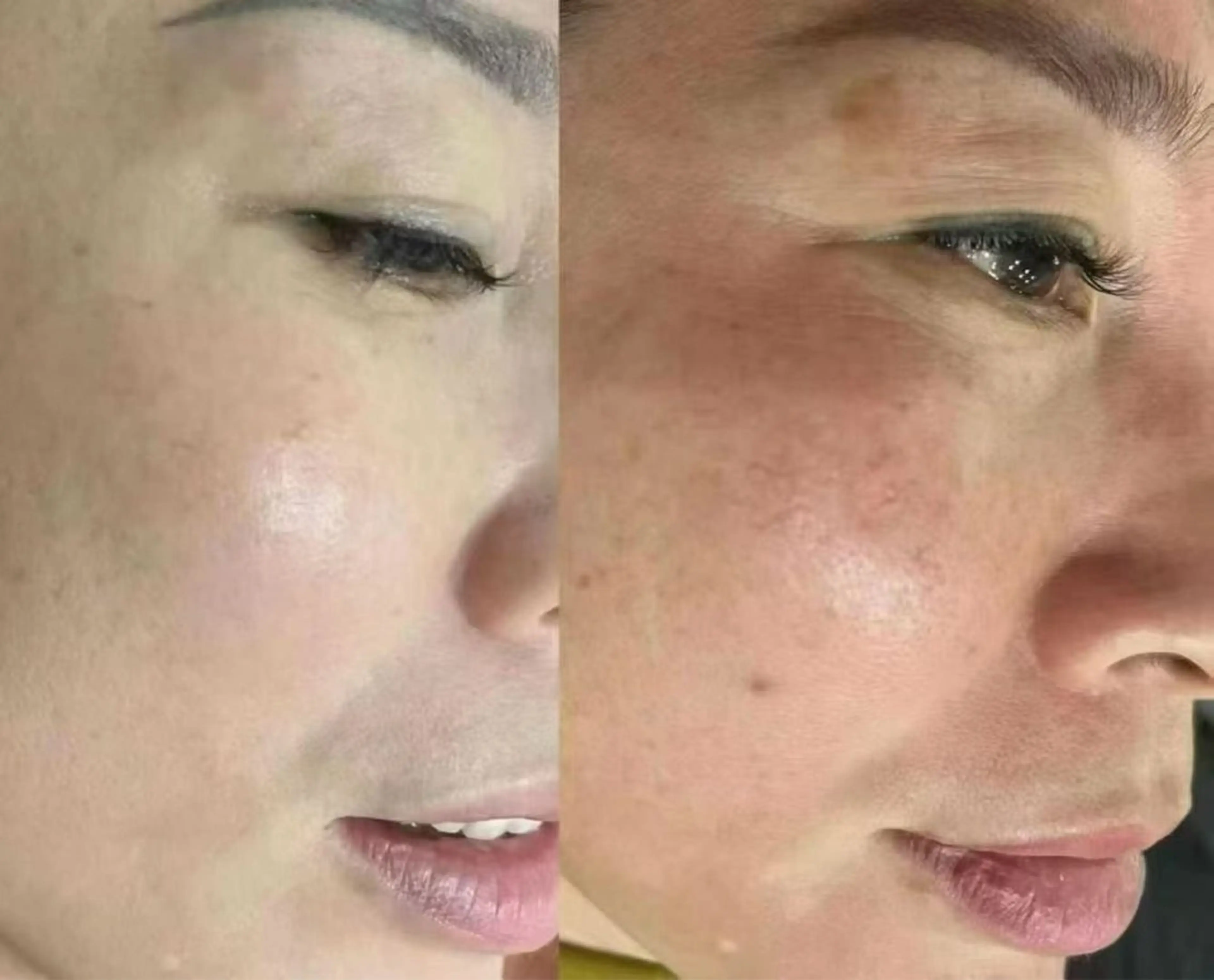 マツエク・マツパ エステ aliaハイフ&水光ジェットサロン所属・aliaハーブ水光店 エステティシャン募集のエステ・リラクイメージ