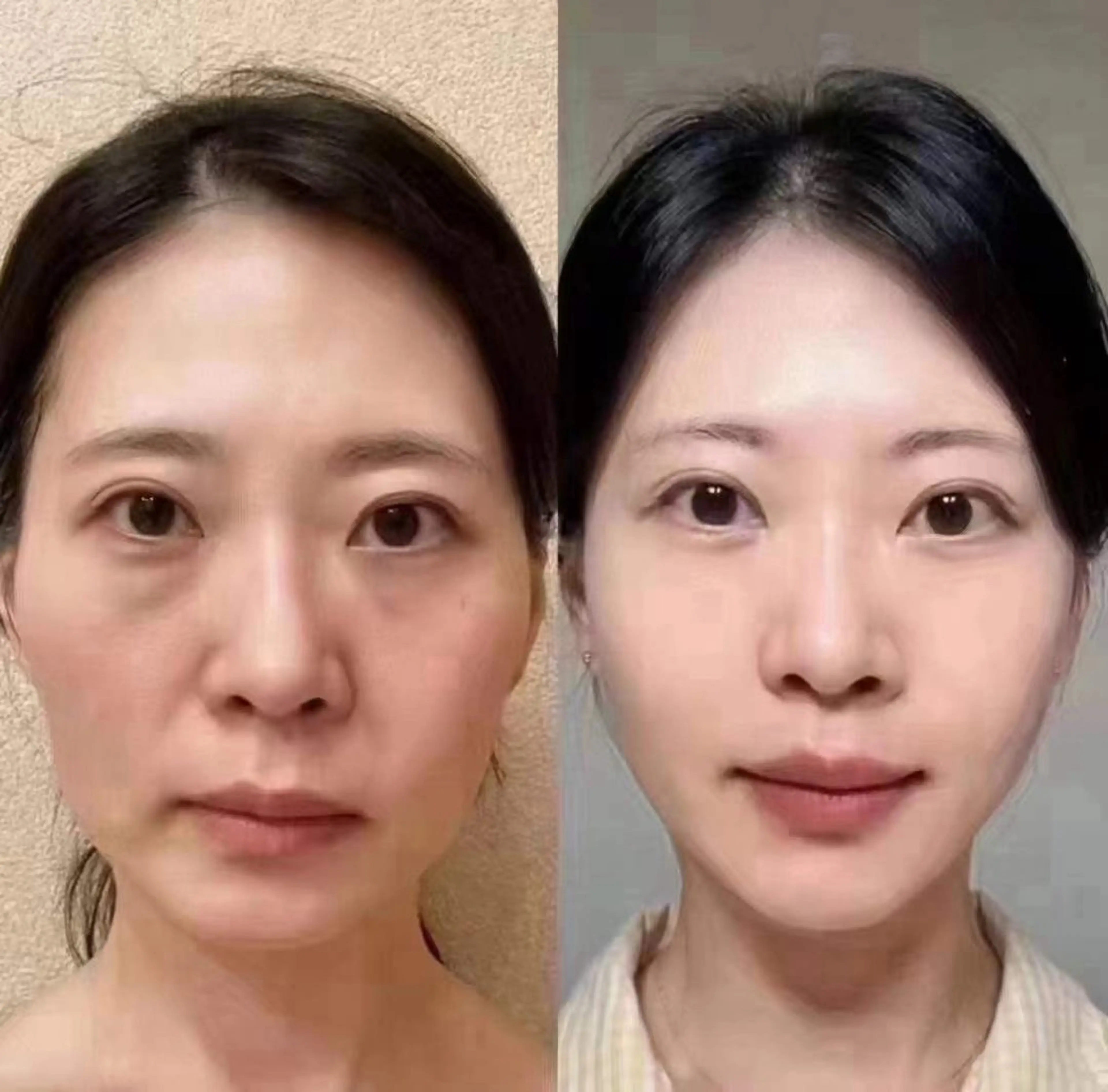 ネイル 韓国ネイル エステ aliaハーブ水光店 エステティシャン募集のエステ・リラクイメージ