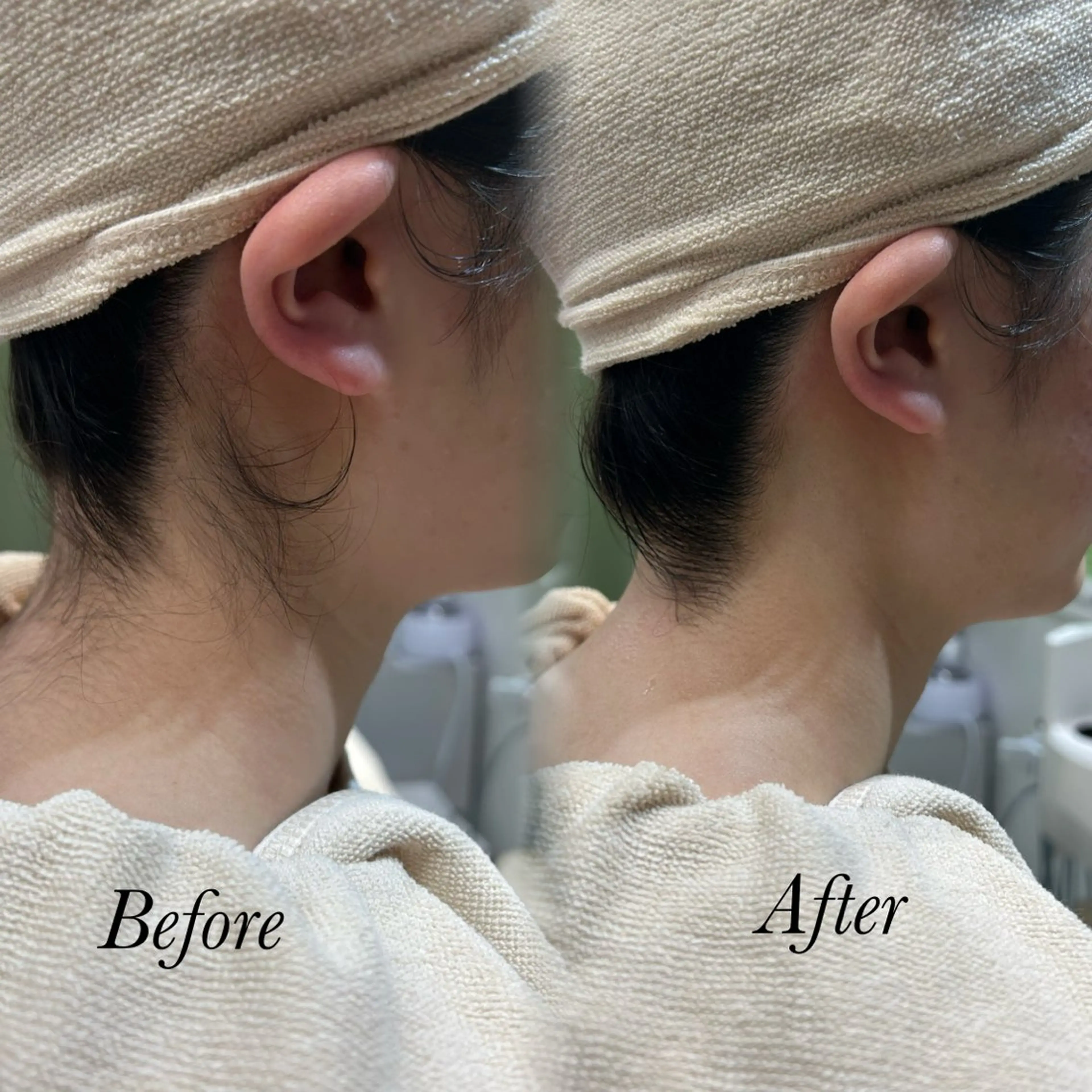 🫧美しい素肌へ🫧 今成柚乃のその他イメージ