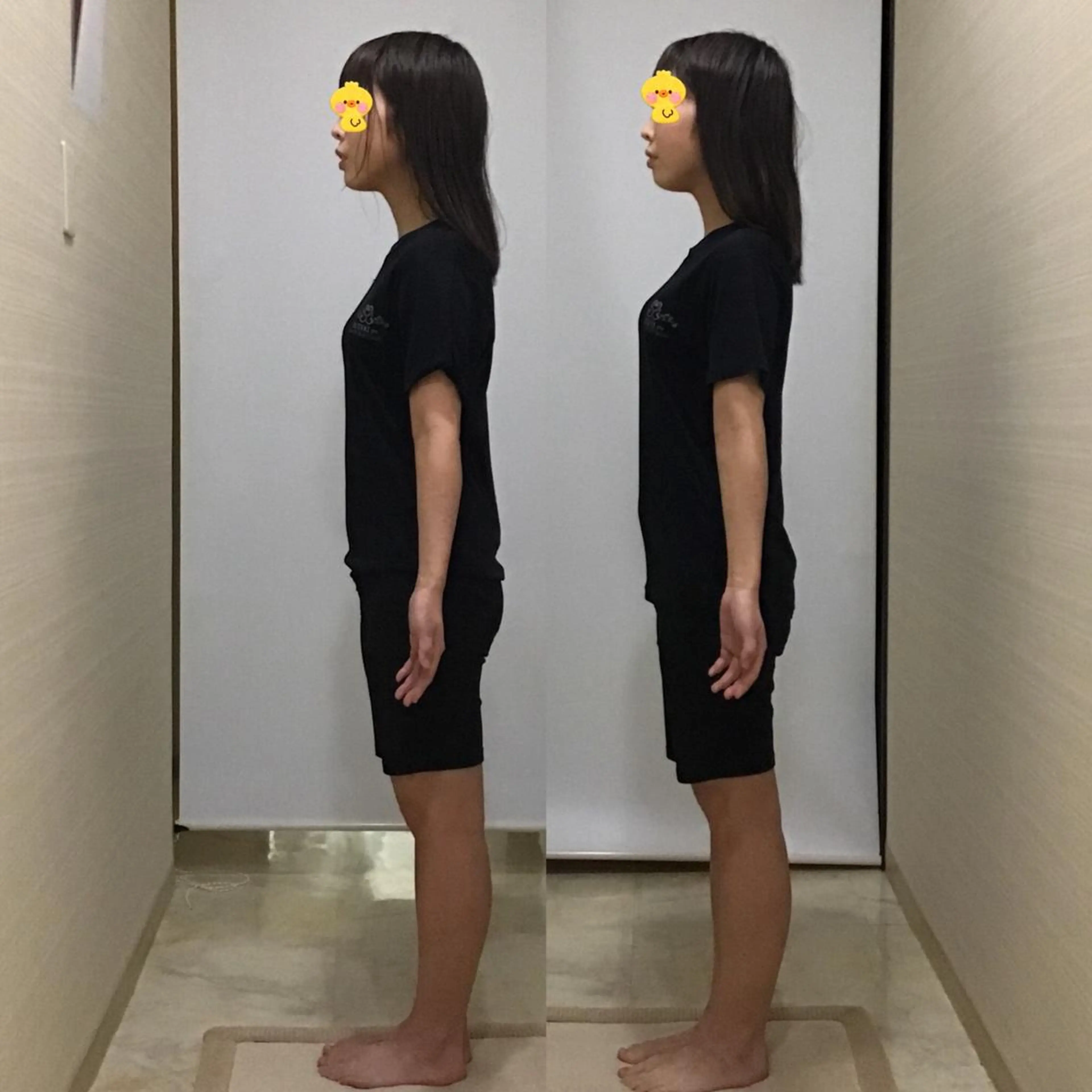 姿勢・骨盤/小顔矯正 痩身ダイエット 横田のエステ・リラクイメージ