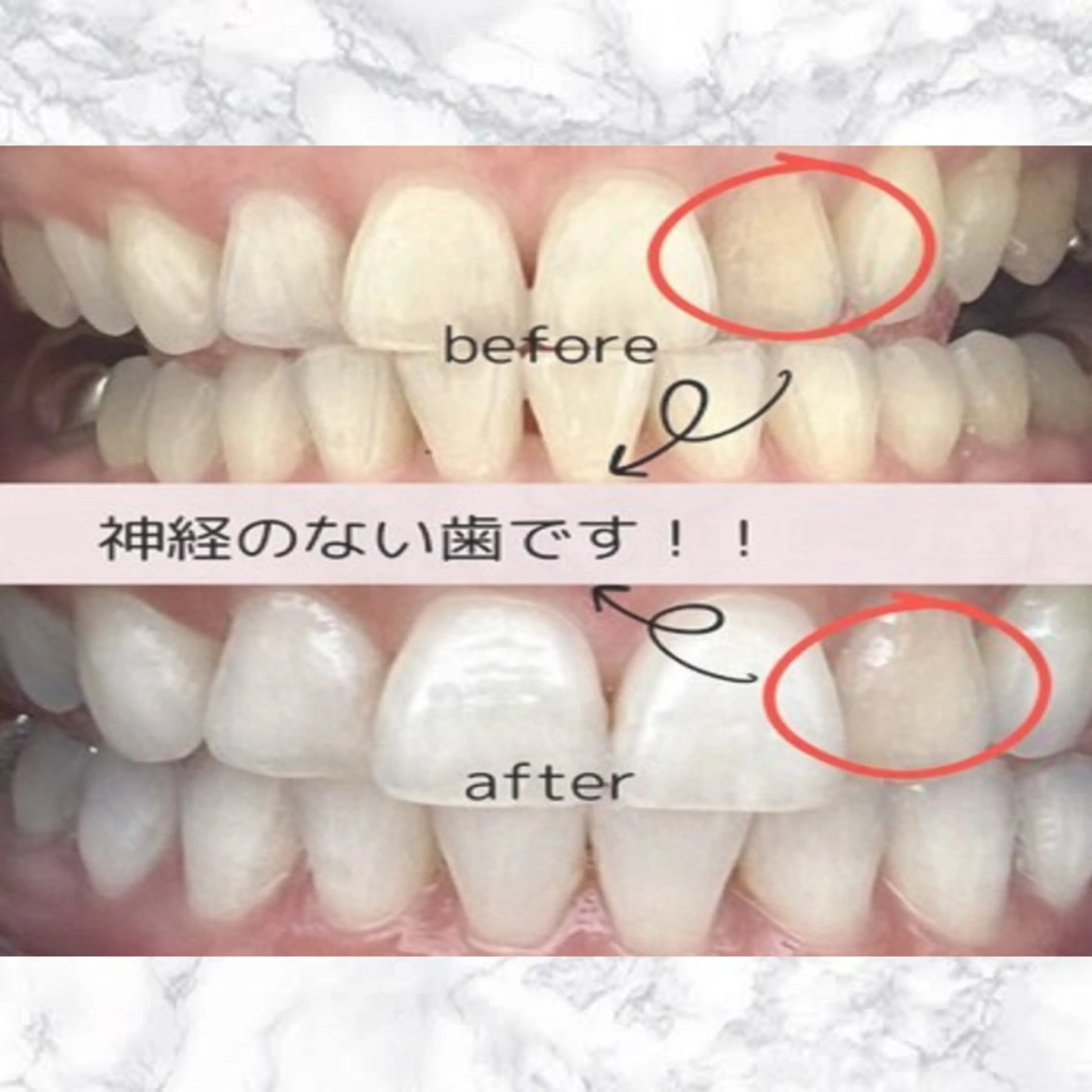 その他 ホワイトニング ショップ津店のその他イメージ