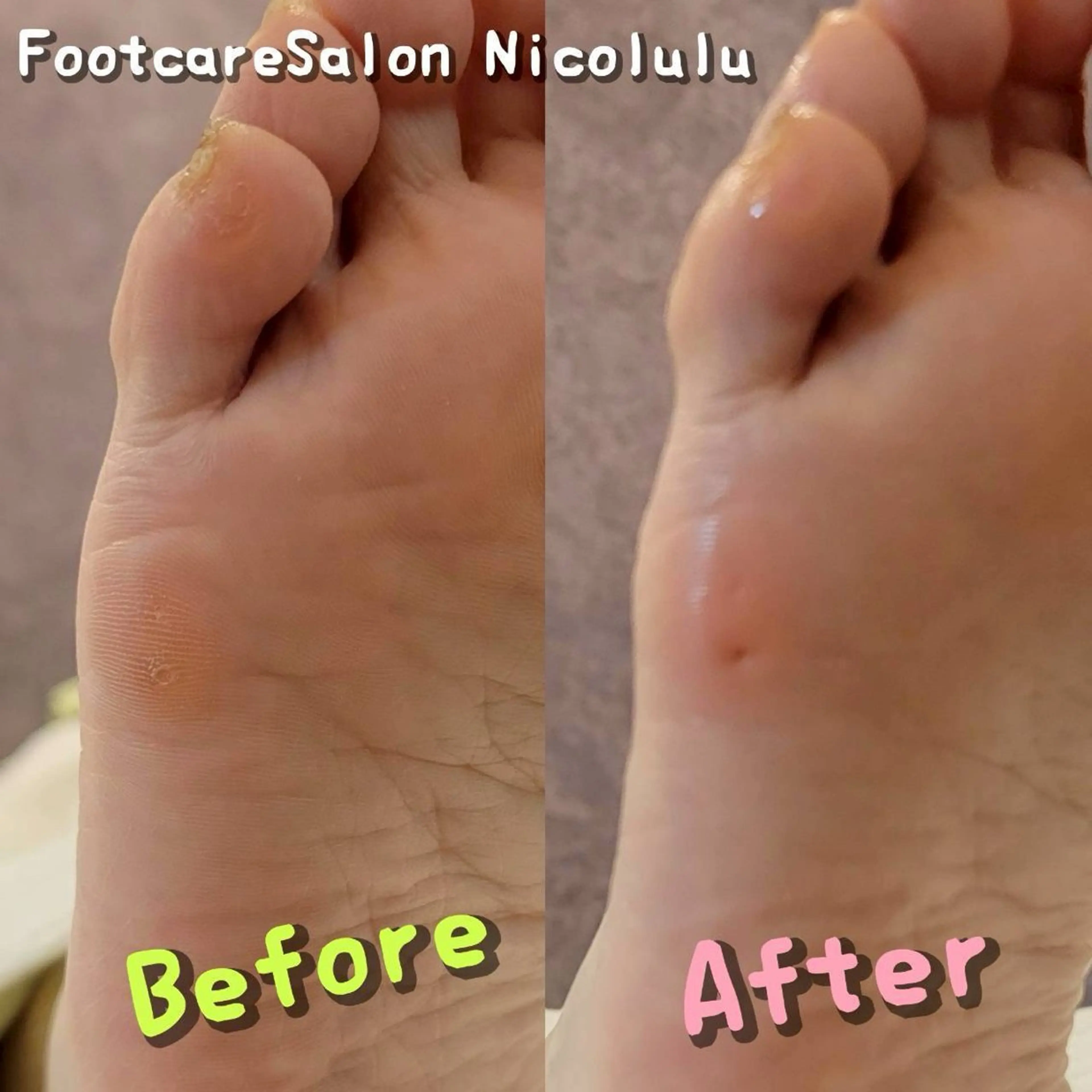 リラク 足トラブル専門 ニコルル金沢のエステ・リラクイメージ