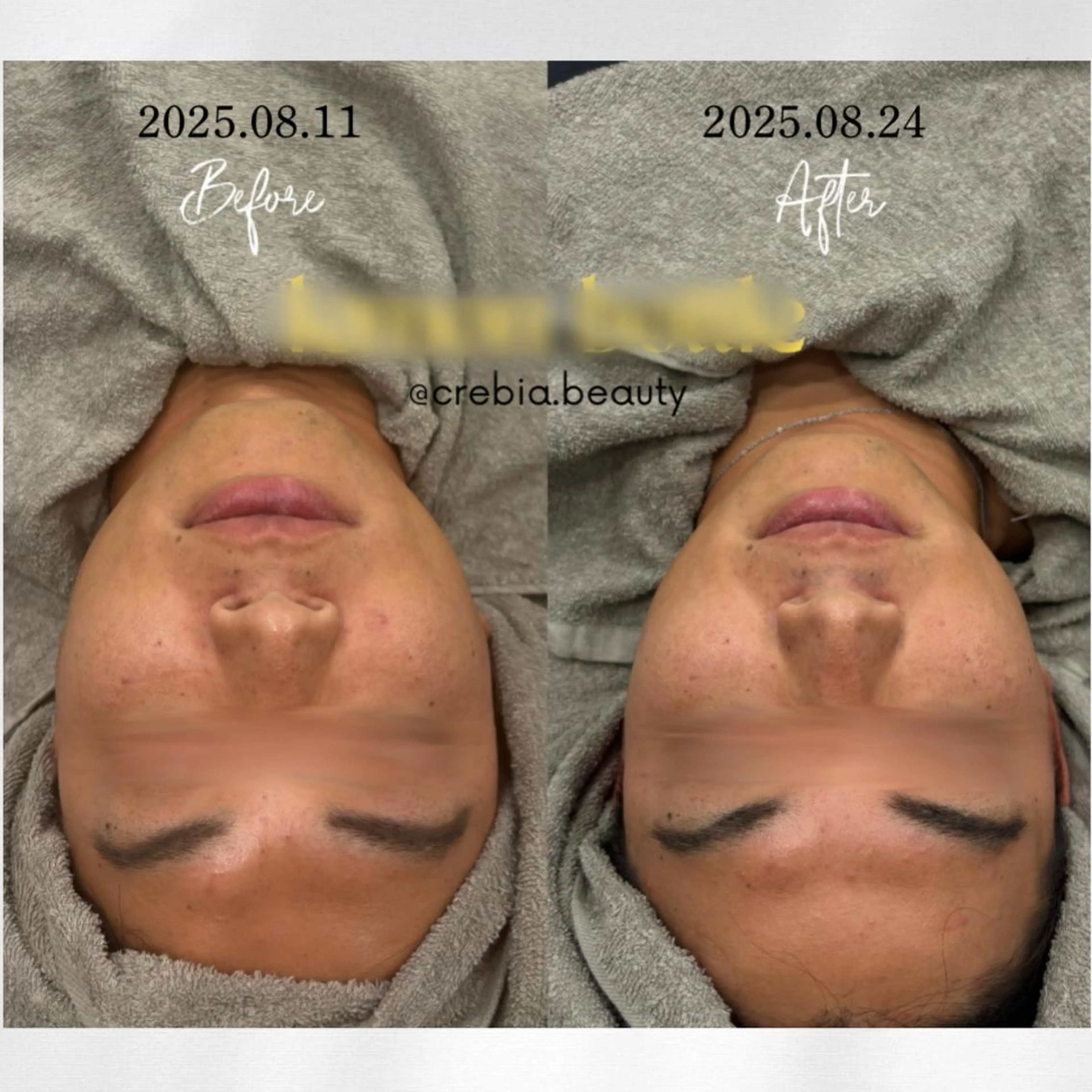 心斎橋🤍堀江.小顔 ハーブ.痩身クレビアのエステ・リラクイメージ