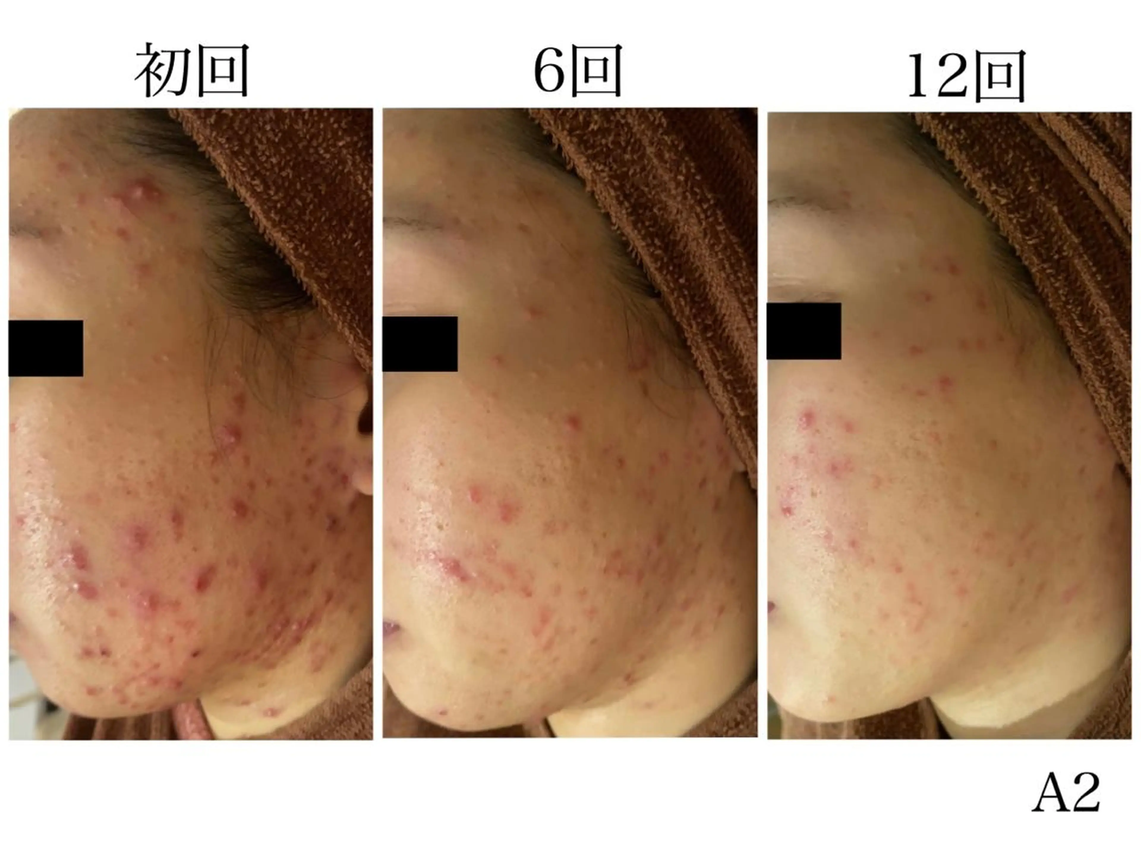 ミディアム メンズ マツエク・マツパ アイブロウ エステ リラク ニキビ・肌質改善専門 ♡人生が変わるサロンのエステ・リラクイメージ