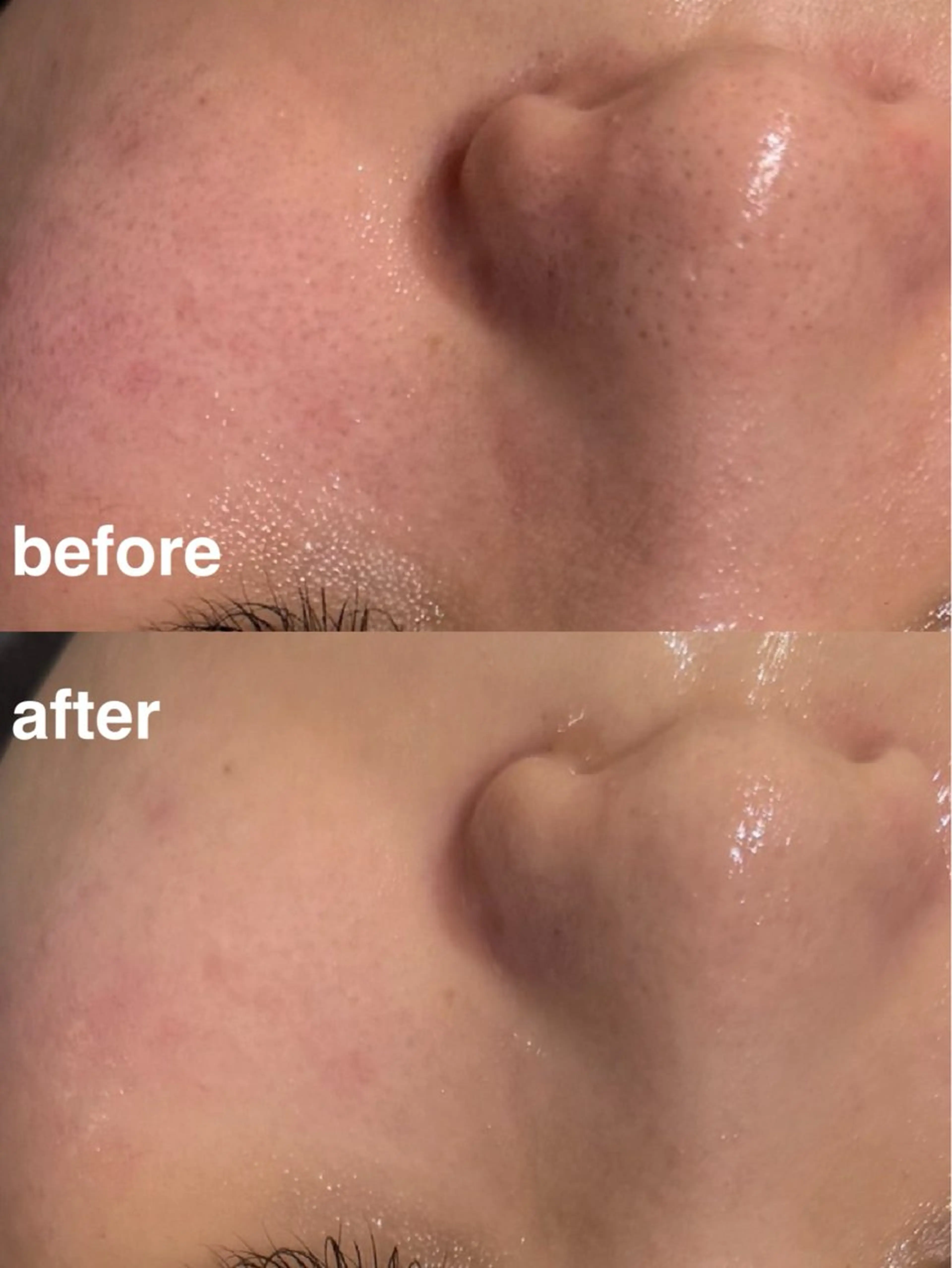 エステ 毛穴と美白の専門店 LAESSE 恵比寿のエステ・リラクイメージ