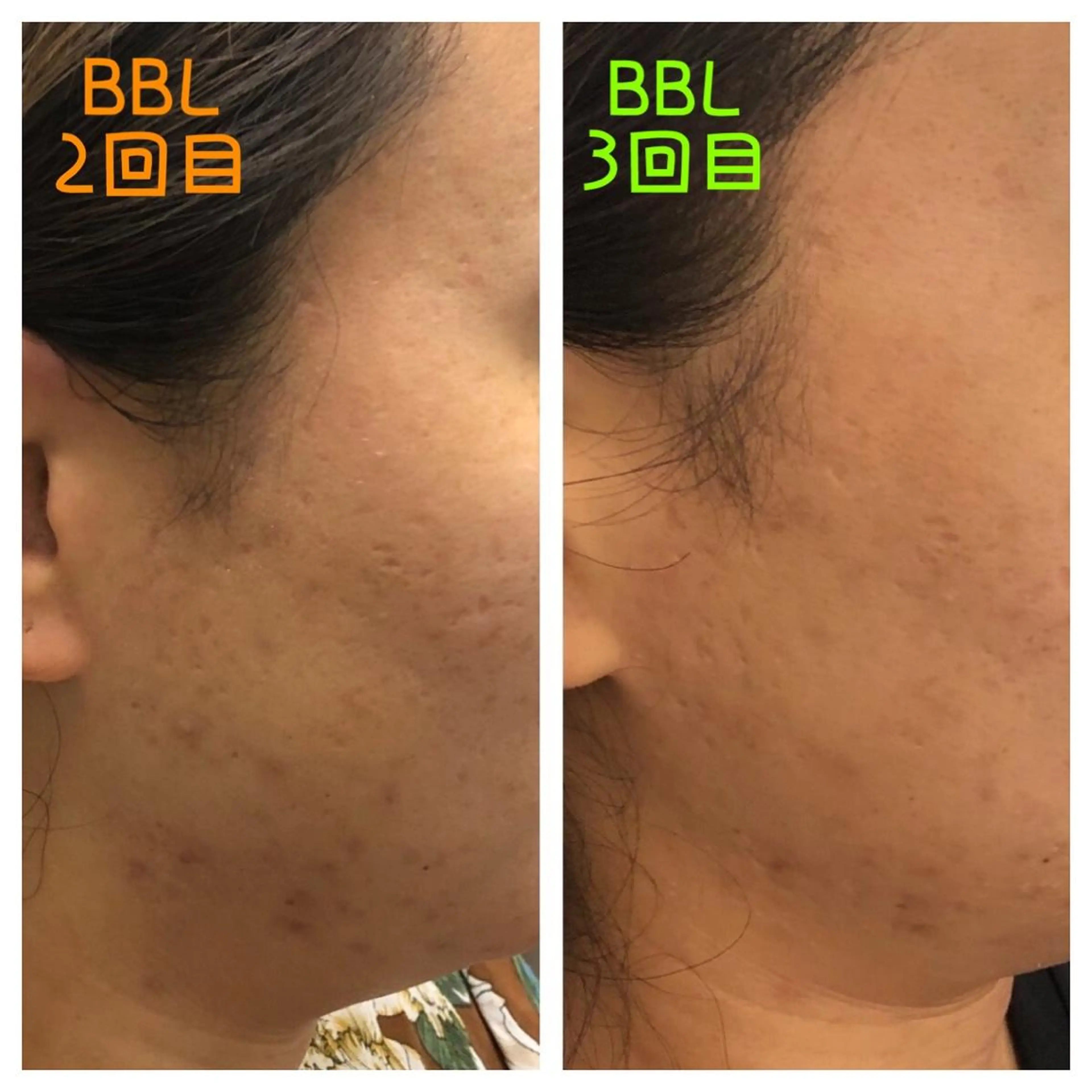 たにがわ整骨院　　salon  de  epila所属・salon   de epilaのエステ・リラクイメージ