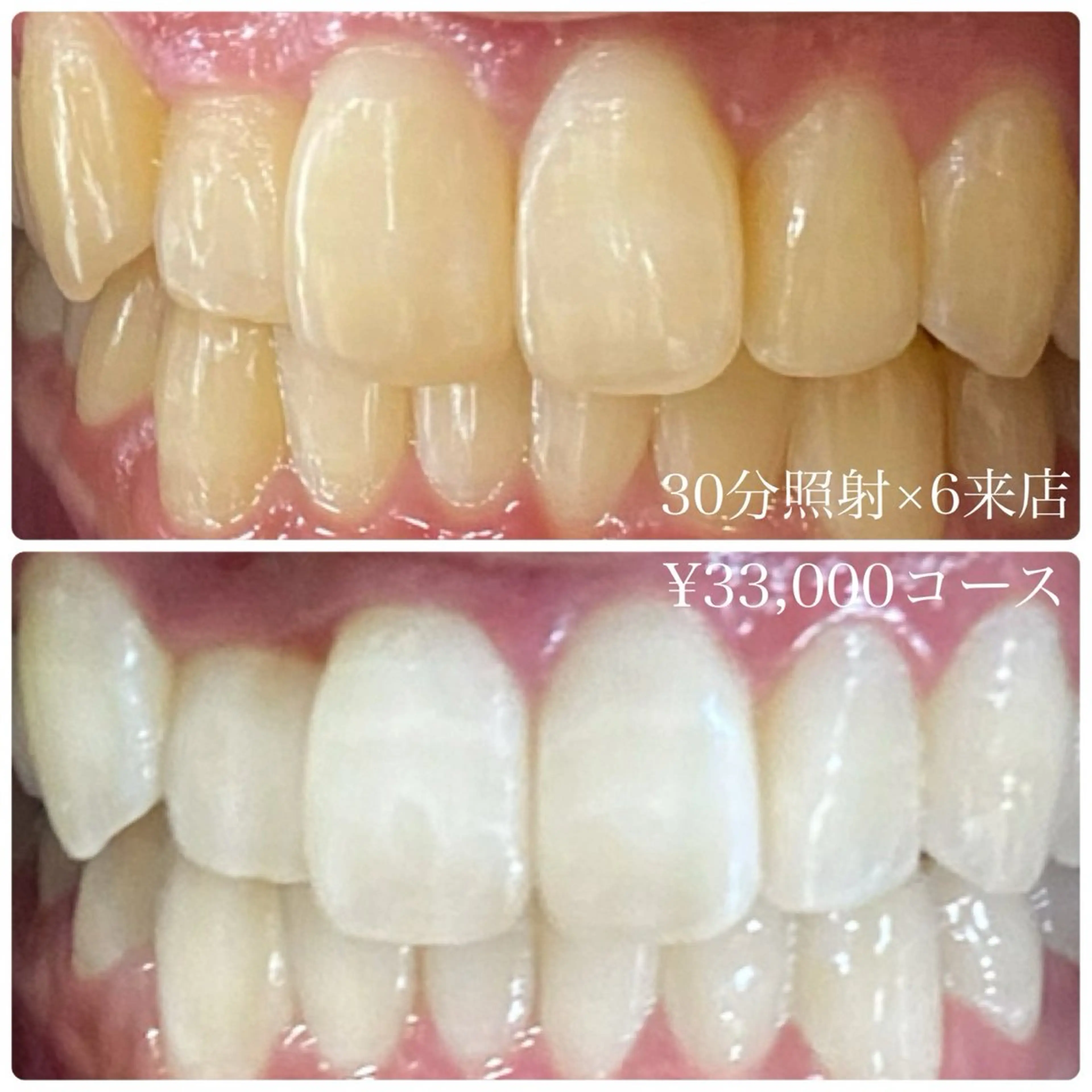 その他 ホワイトニングルーム 横浜店のその他イメージ