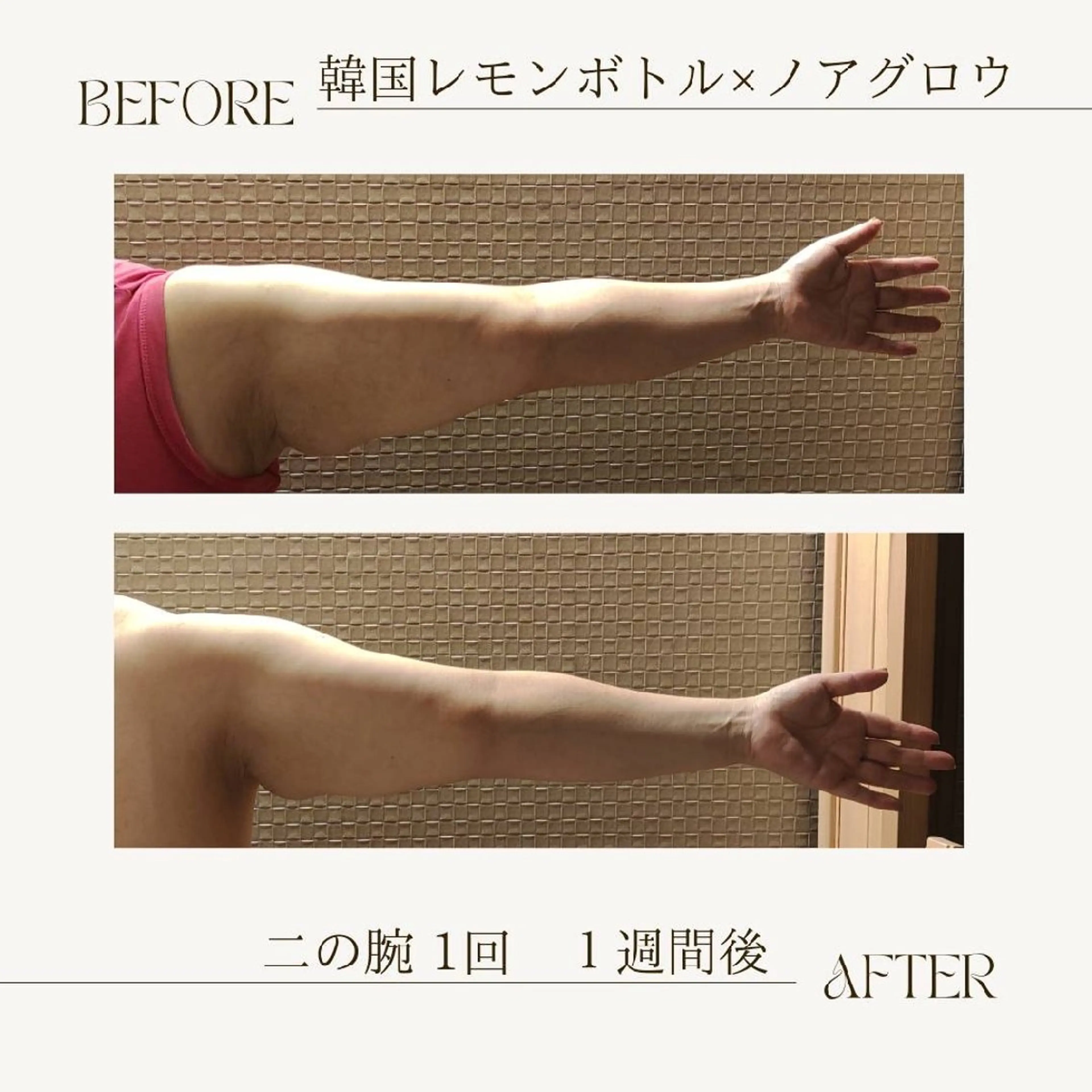 痩身小顔専門 アマテ ビューティー.Nのエステ・リラクイメージ