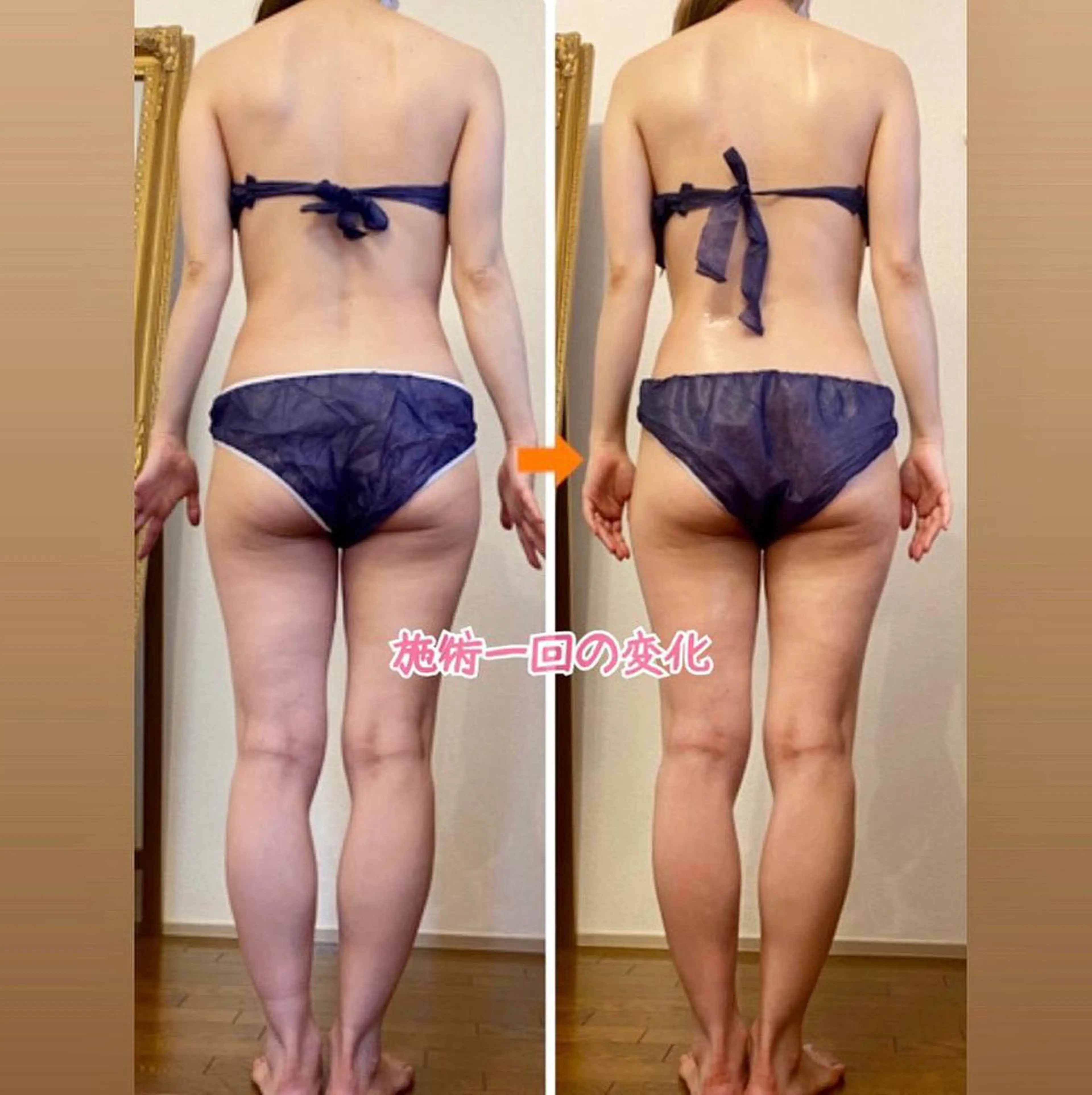 ショート カラー パーマ ヘアアレンジ メンズ キッズ ネイル マツエク・マツパ エステ リラク ‍痩身＆ボディ 結果出し🌟丹野のエステ・リラクイメージ