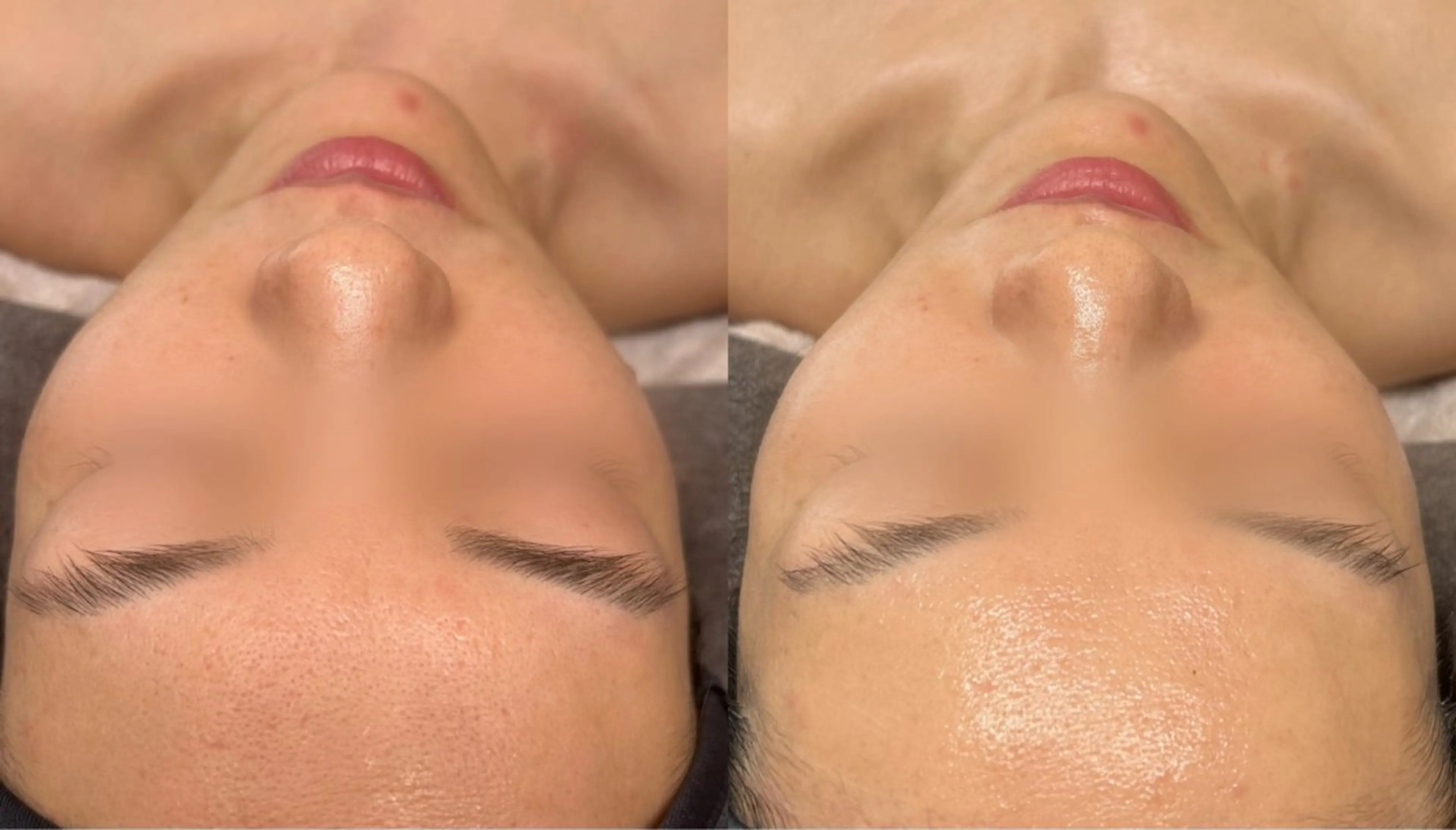 Le cherienのエステ・リラクイメージ