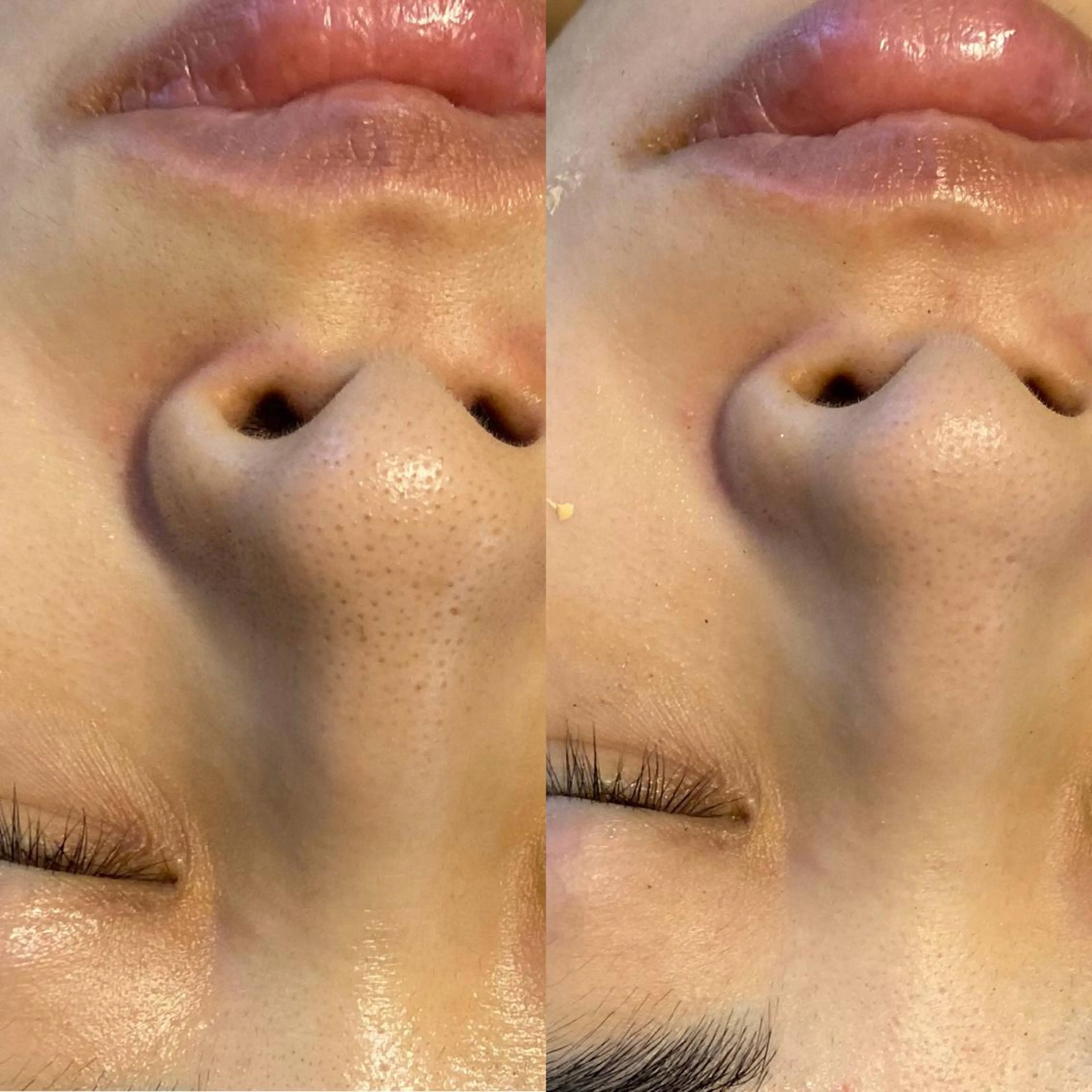 Meetite 小林のエステ・リラクイメージ