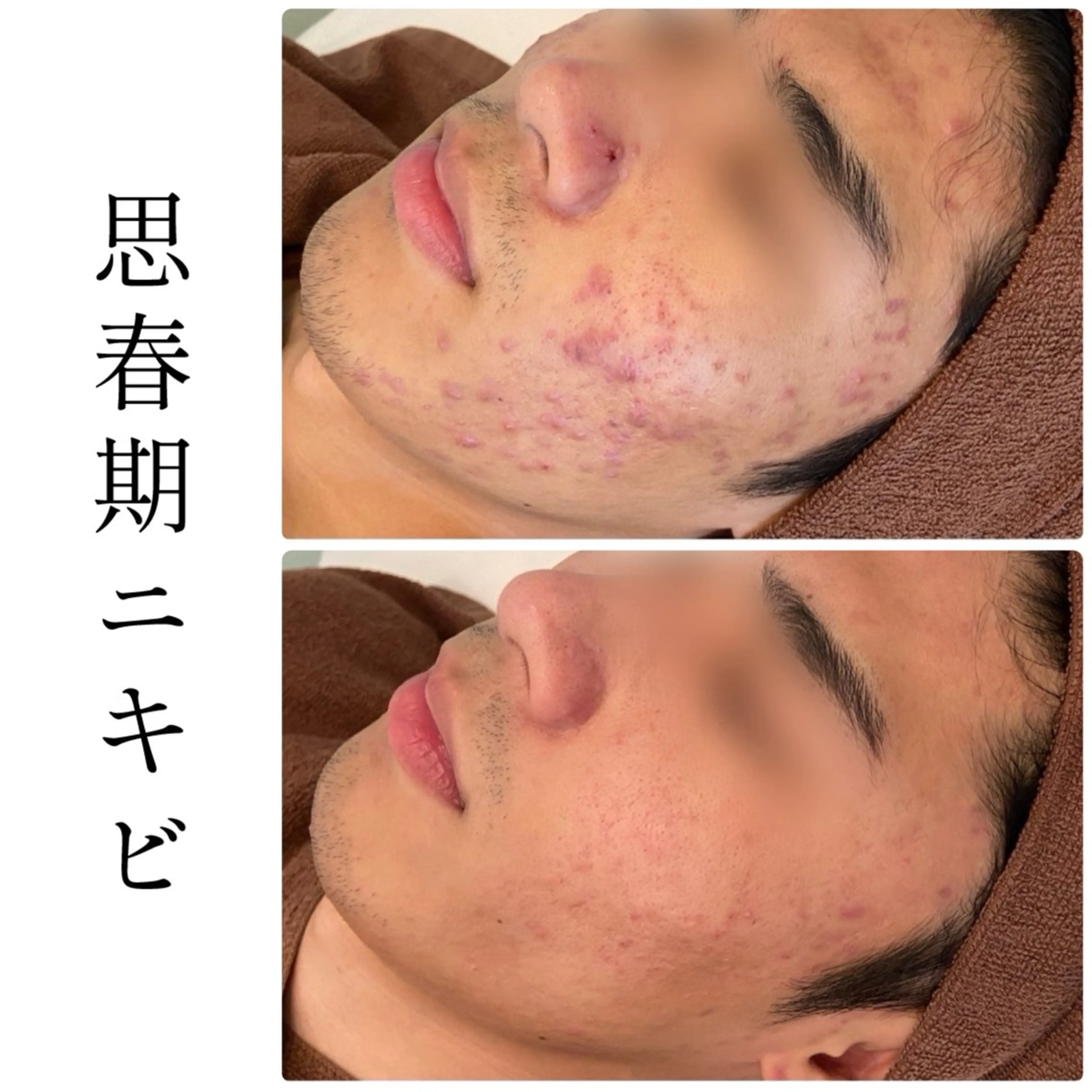 ハーブピーリング専門 BIOEL横浜のエステ・リラクイメージ