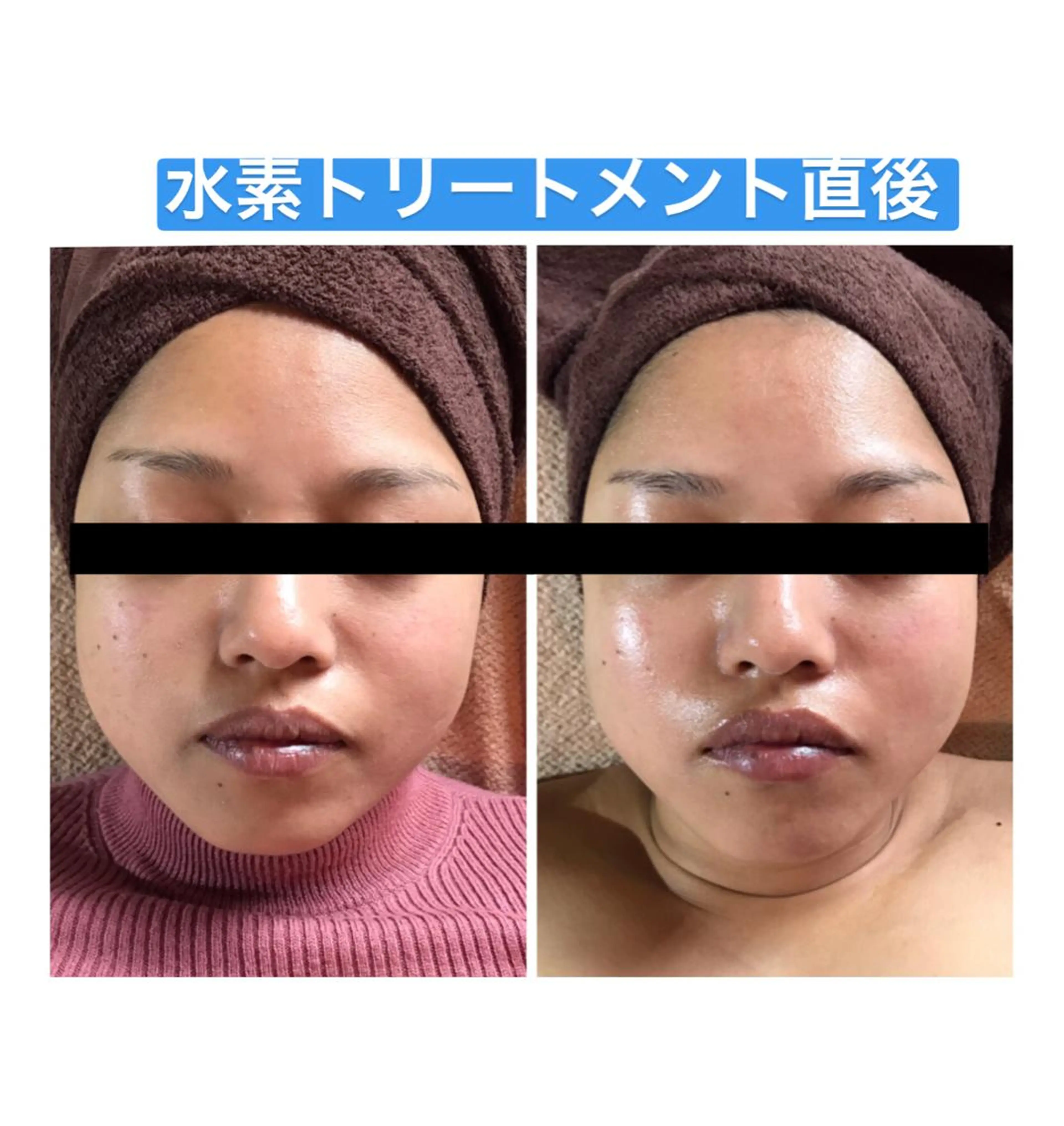 代表 MOMOのエステ・リラクイメージ