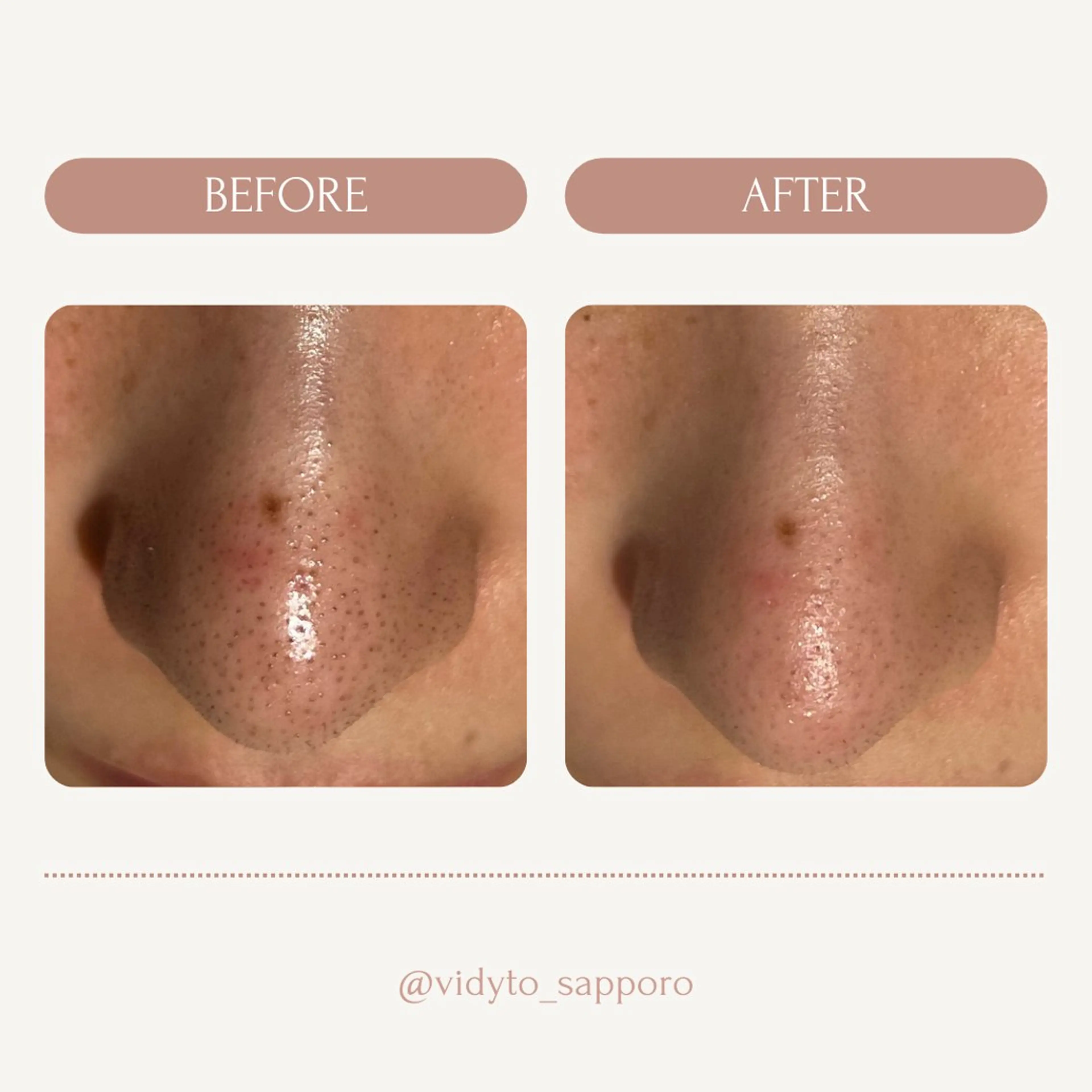 エステ リラク 肌管理サロン vidyto　MOEのエステ・リラクイメージ