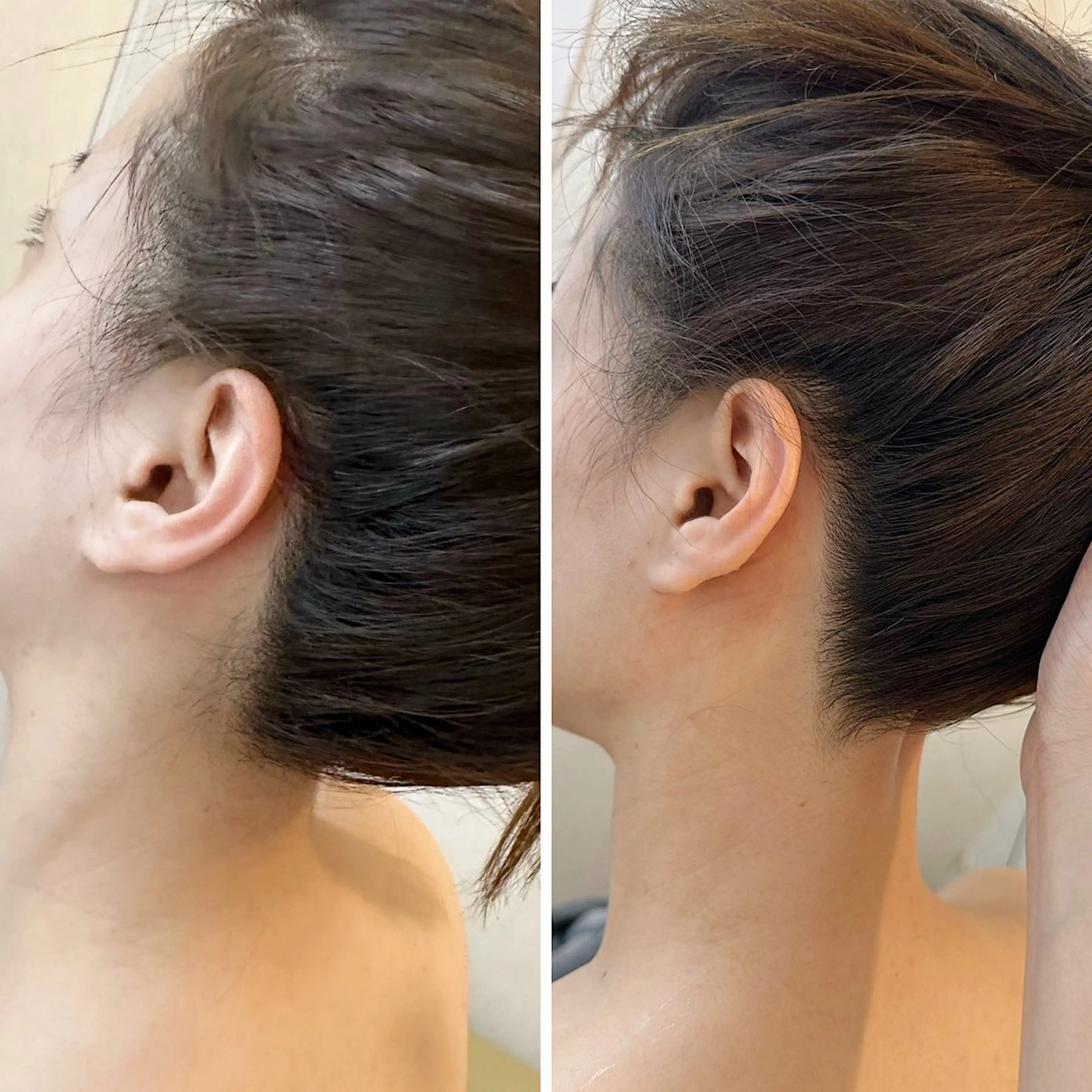 脱毛 うなじ脱毛/美肌脱毛 LABELのエステ・リラクイメージ