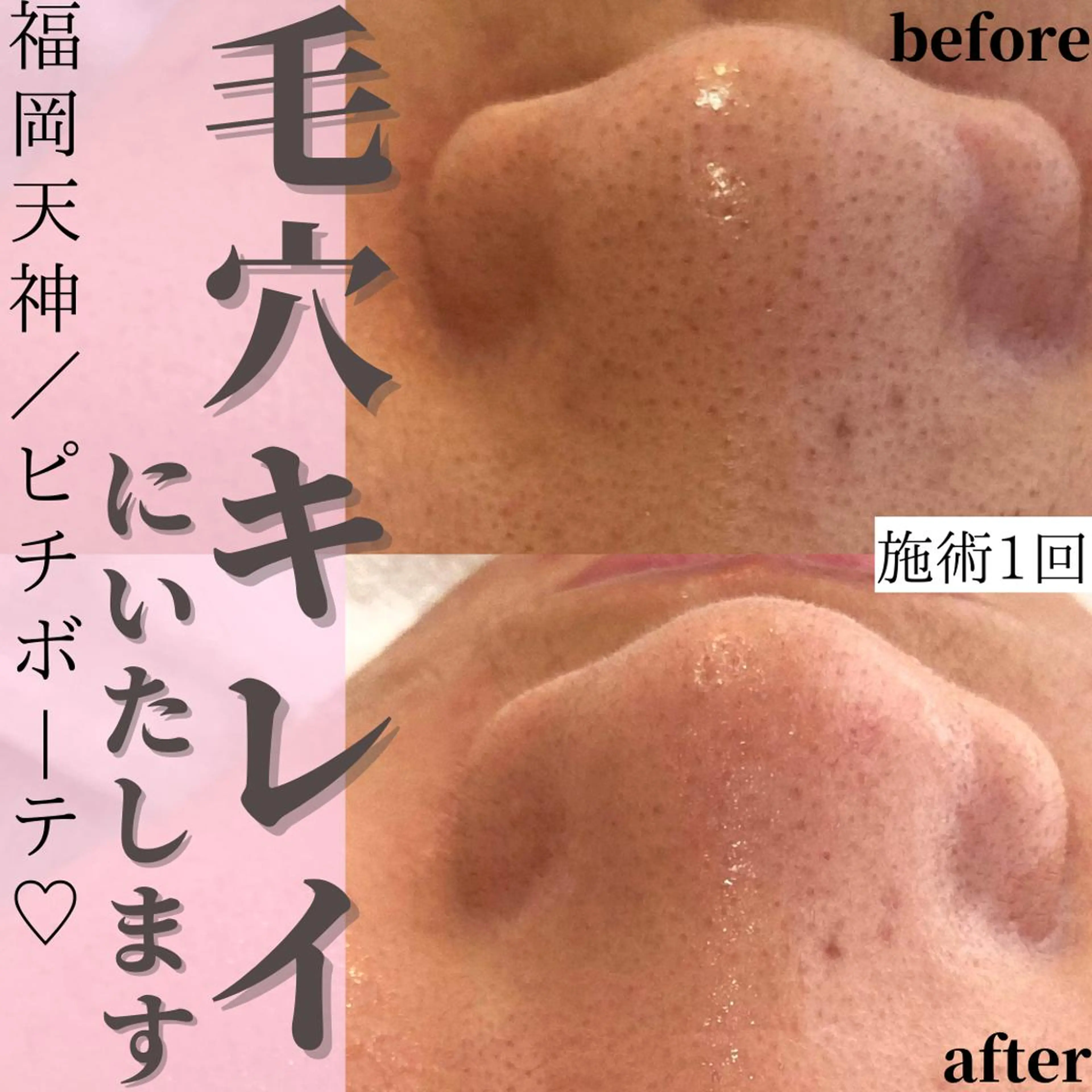 トクシゲ マホのエステ・リラクイメージ