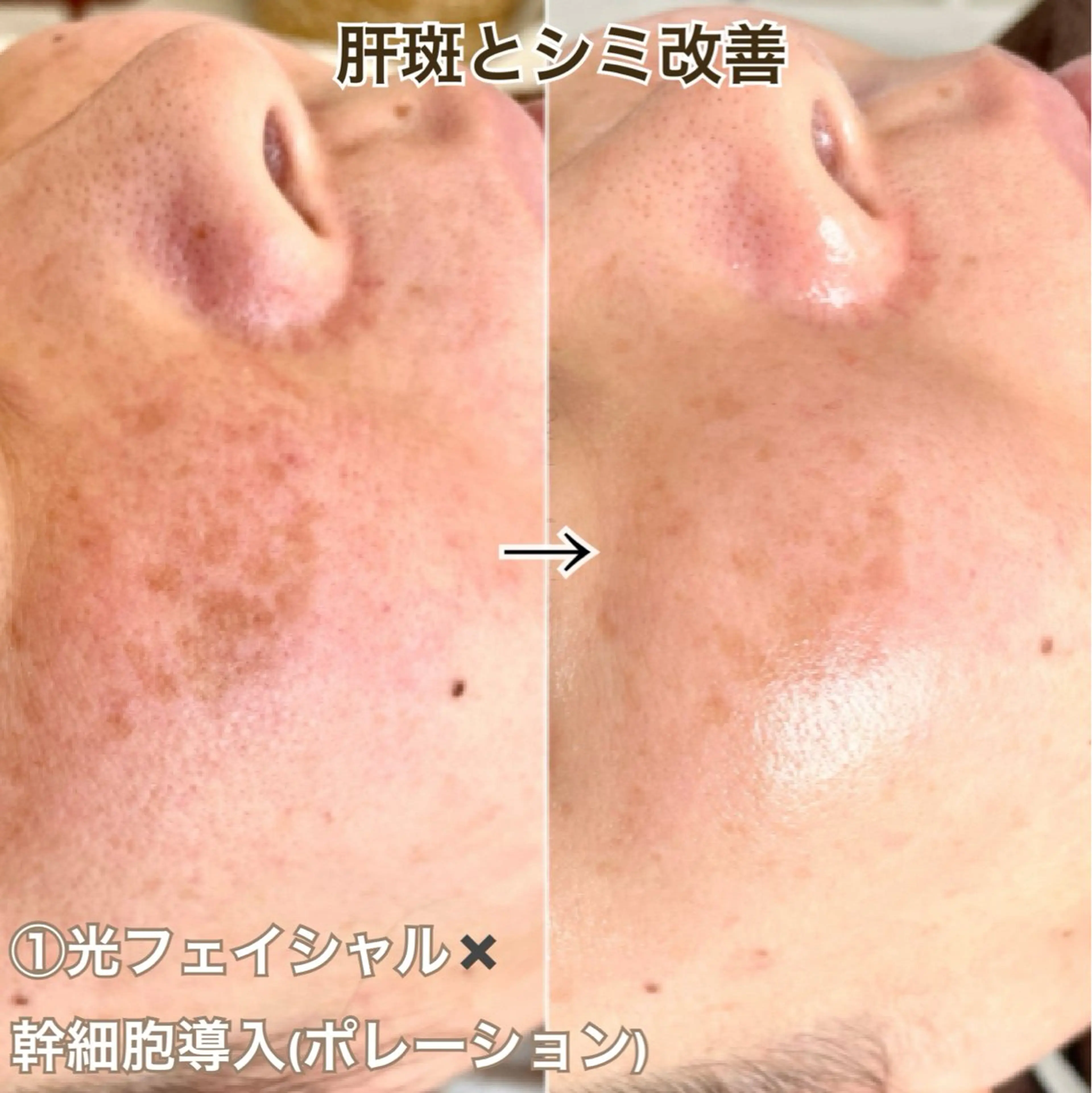 エステ 毛穴と美白の専門店 LAESSE 恵比寿のエステ・リラクイメージ