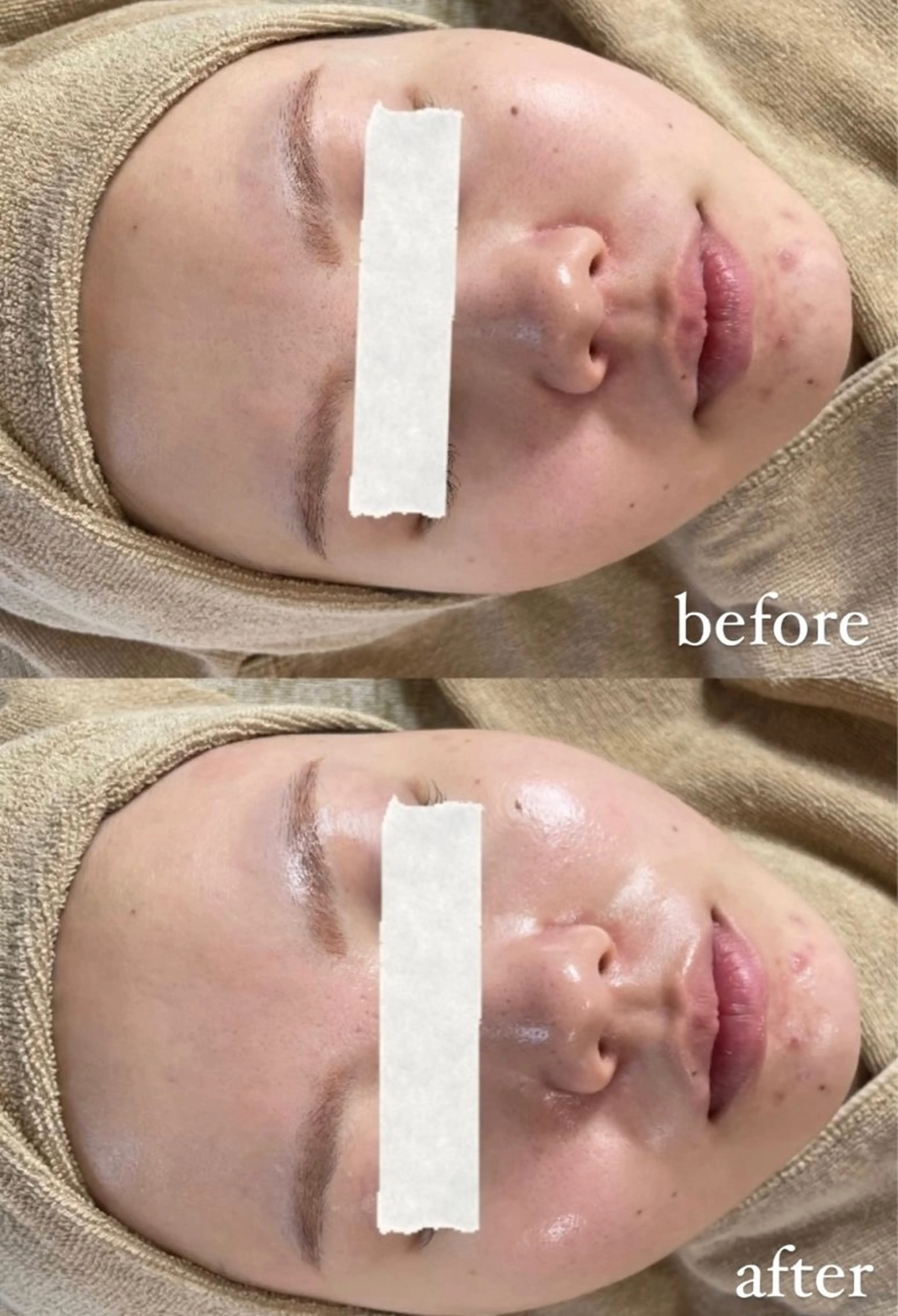 脱毛 エステサロン Mi-mi.iのエステ・リラクイメージ