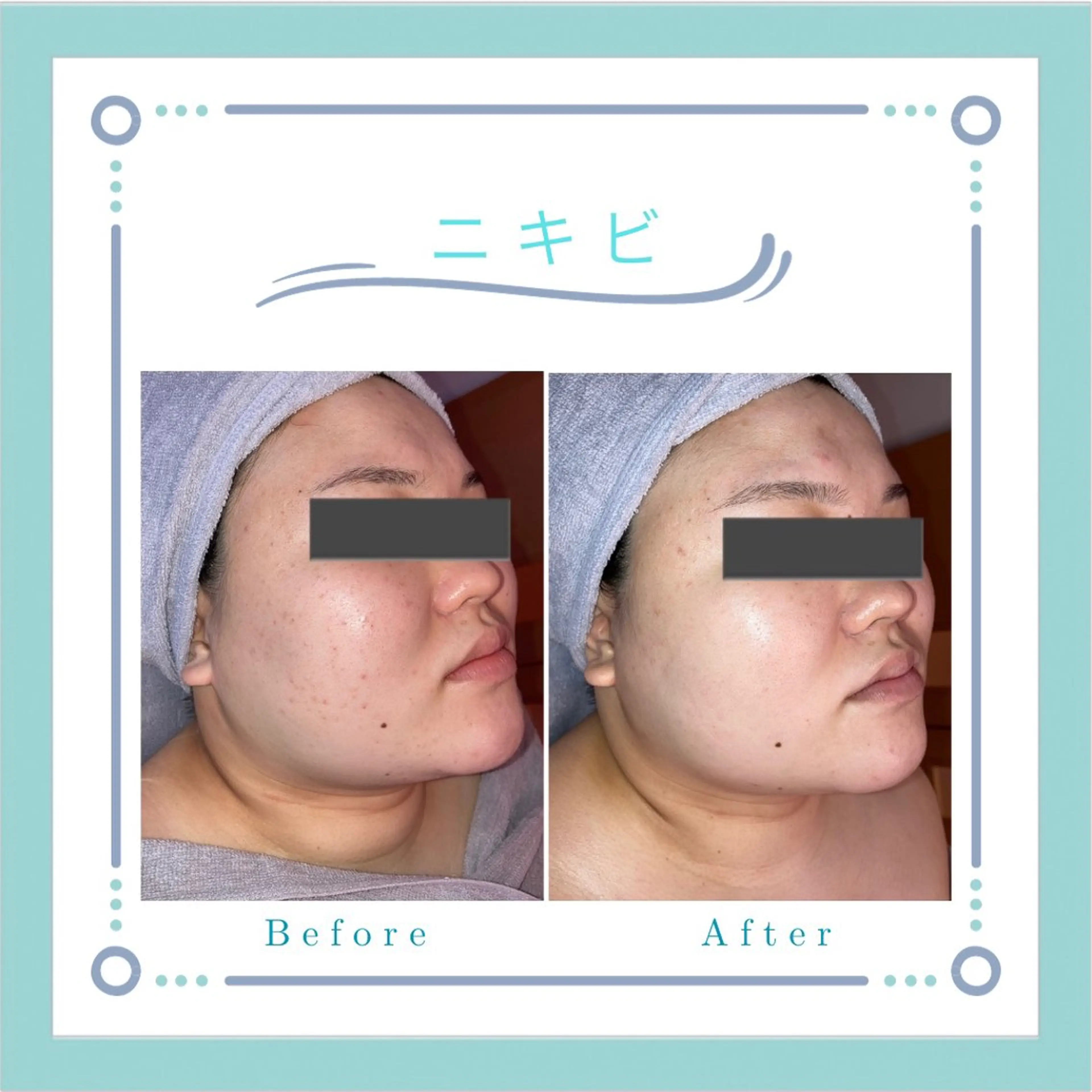 Le・Ciel フェイシャル&ボディのエステ・リラクイメージ