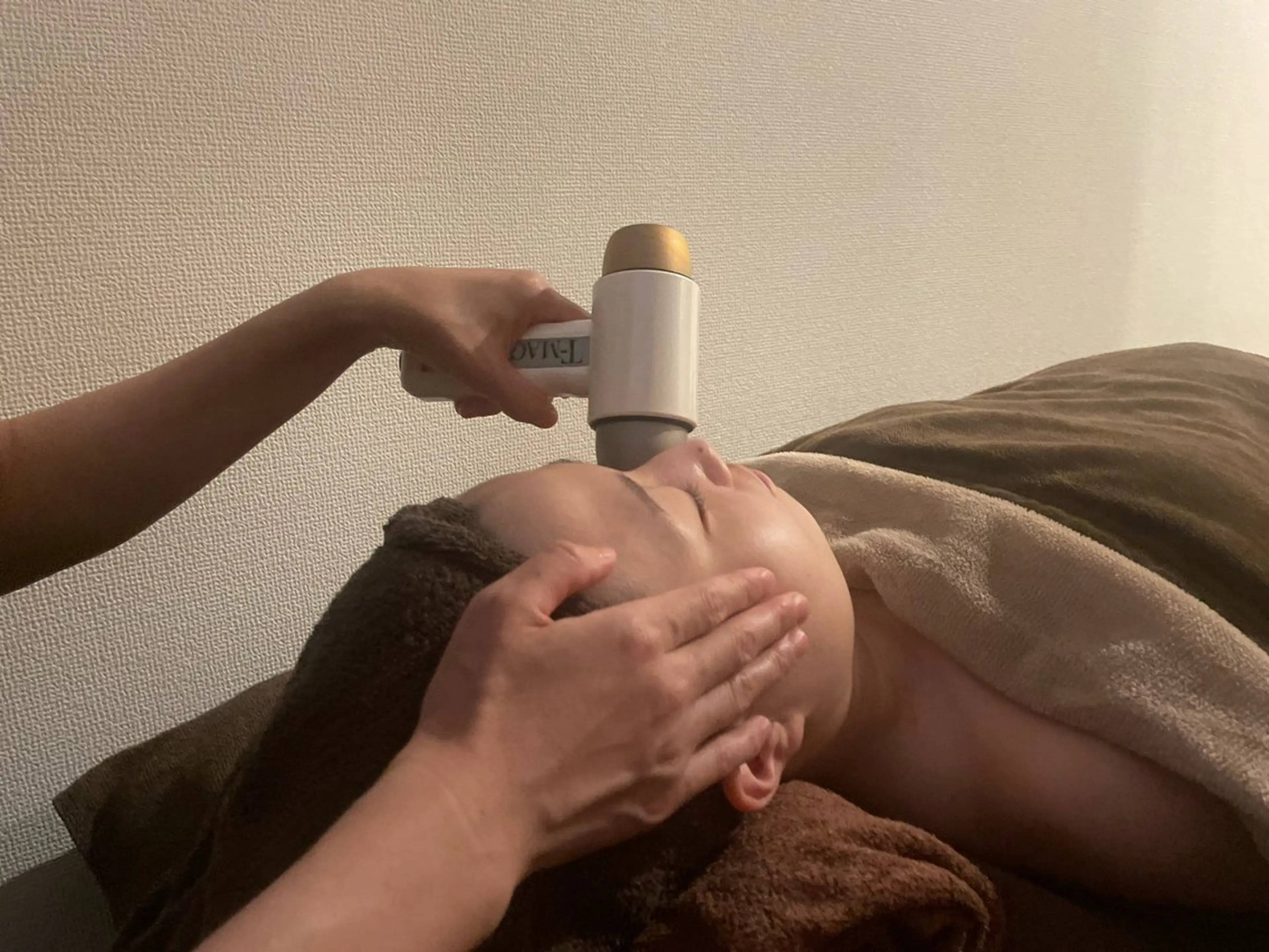 【シミ・くすみが気になり始めた方へ】トラネキサム酸ポレーション導入(透明感ケア)の写真