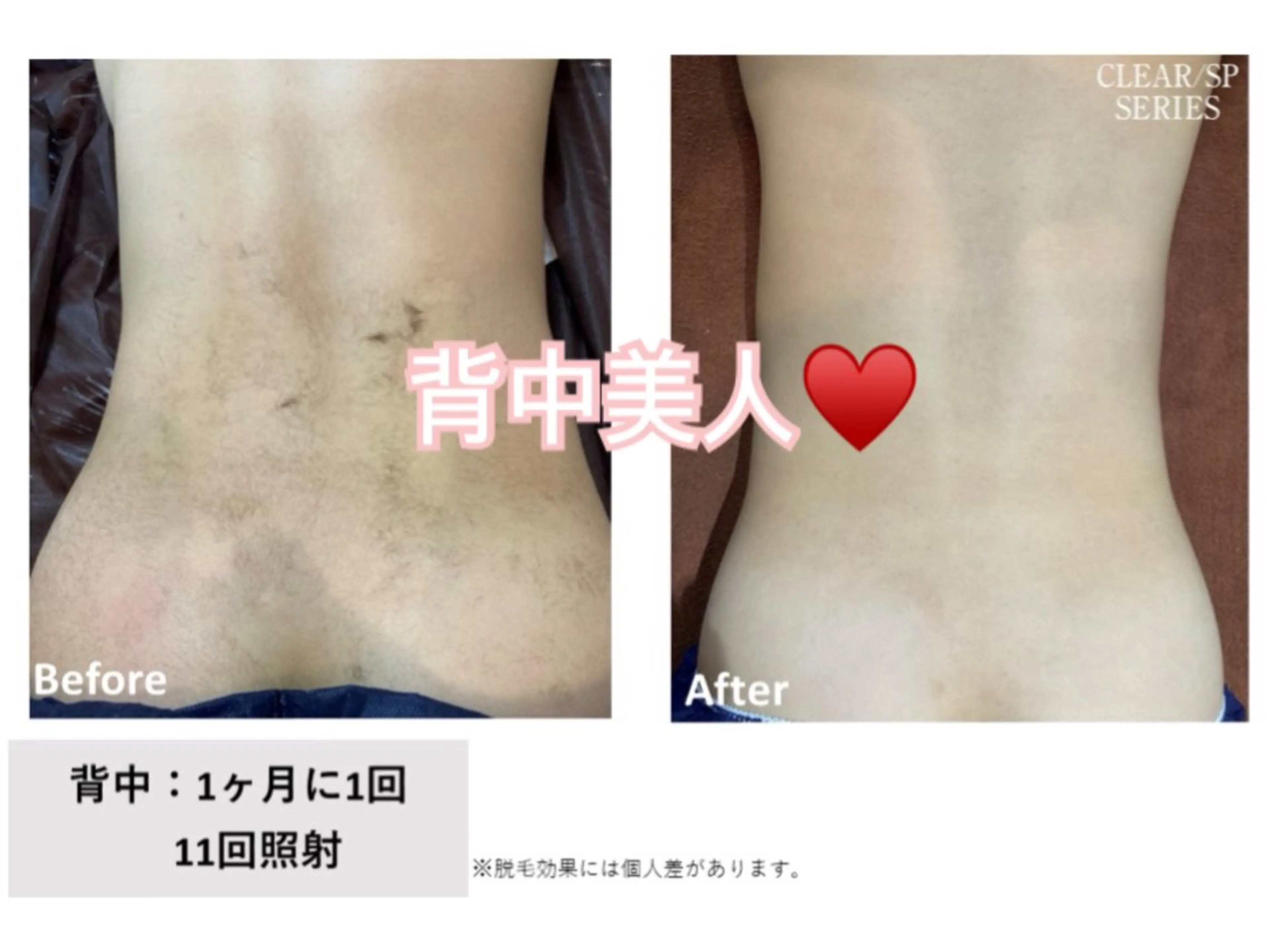 脱毛 プライベートサロン Allureアルーアのエステ・リラクイメージ