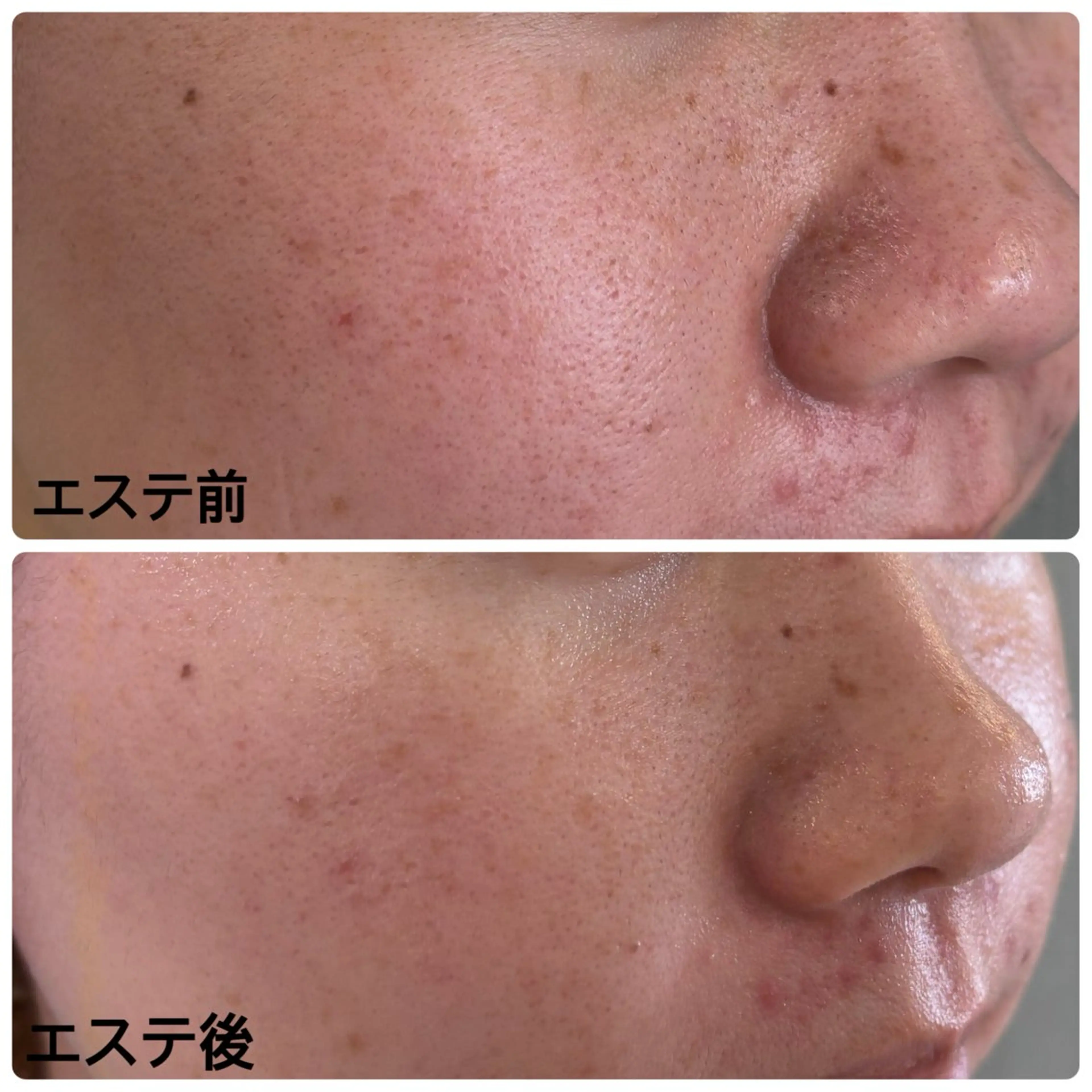 エステ リラク 網代 綾美のエステ・リラクイメージ