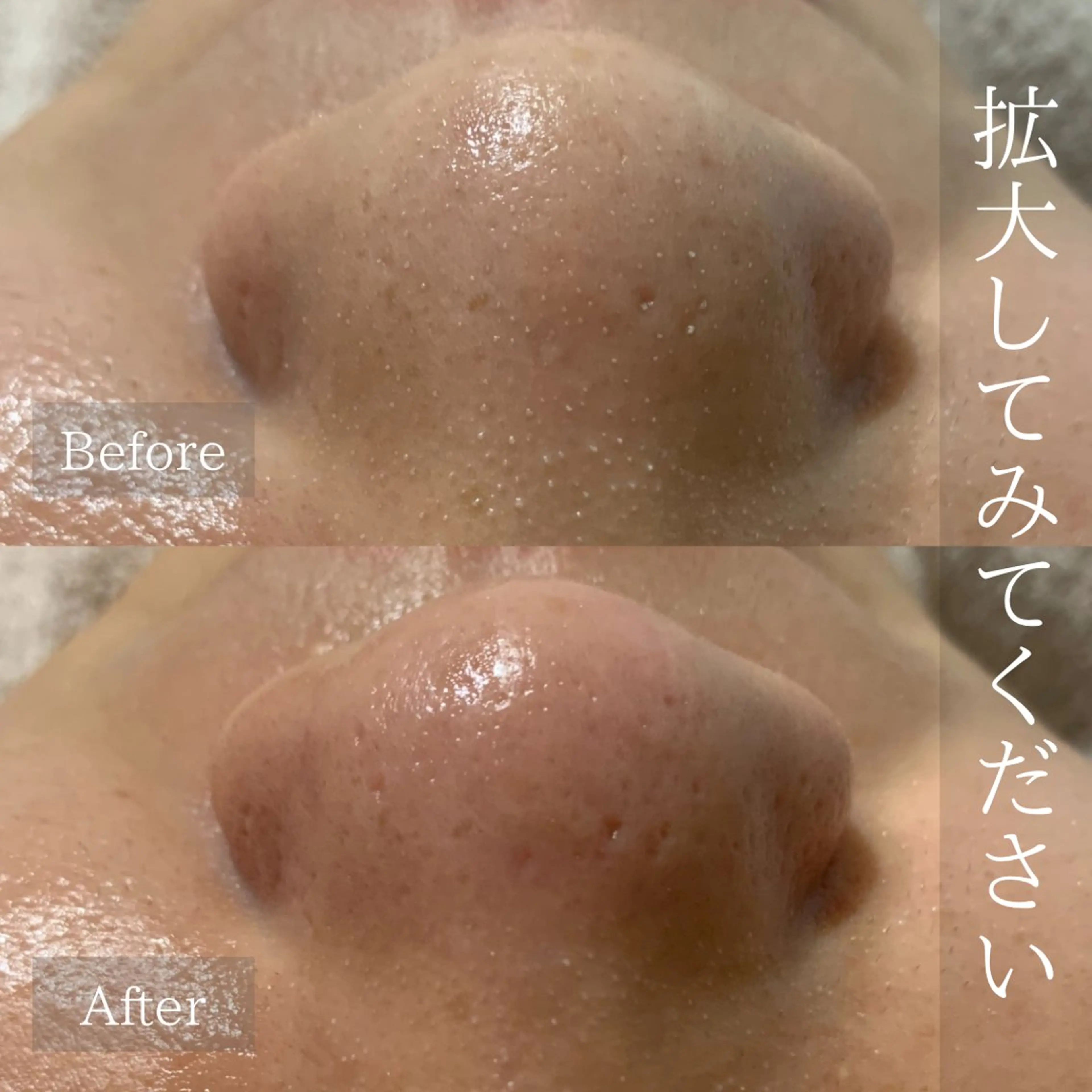 emiiny 🌿フェイシャルのエステ・リラクイメージ