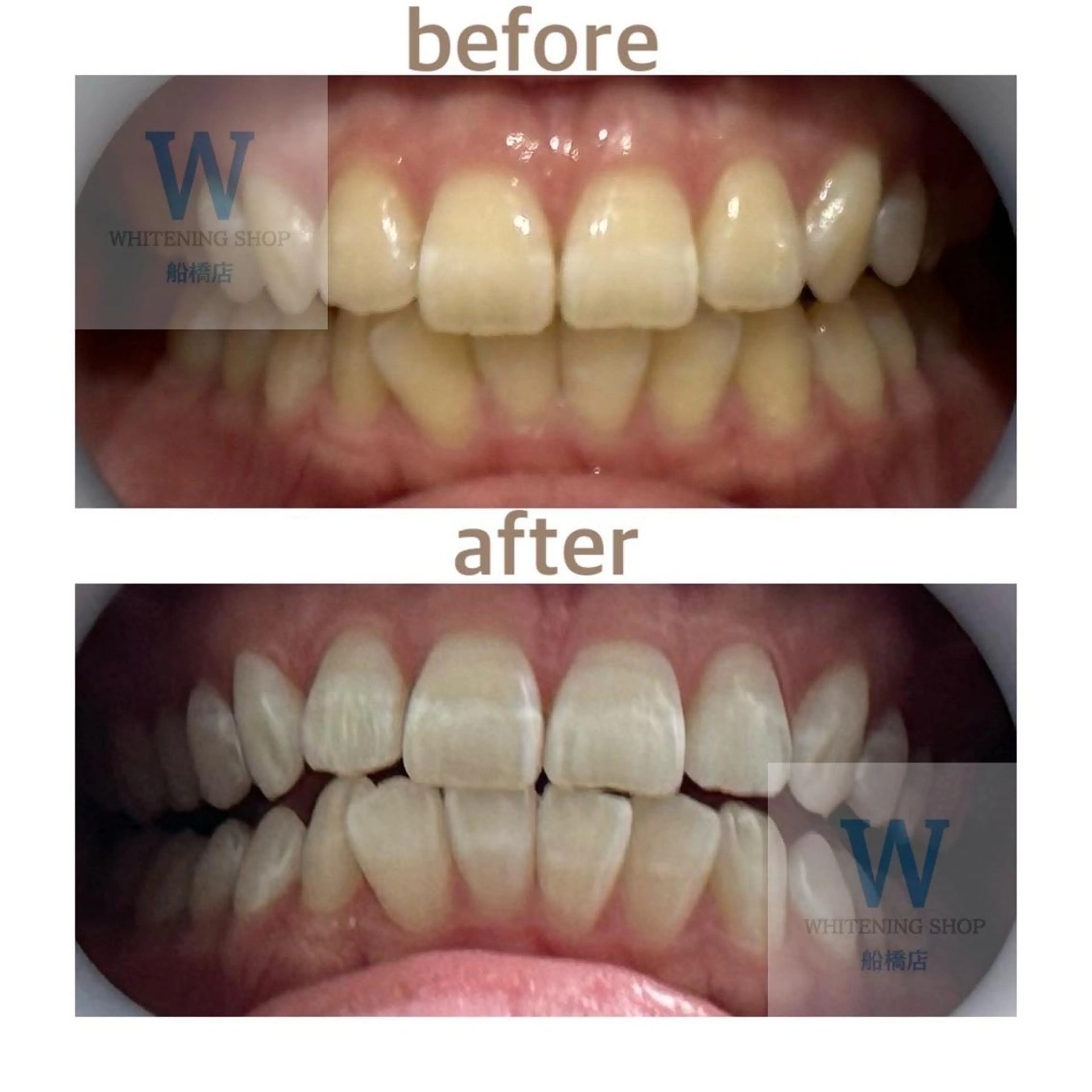 ホワイトニング ショップ船橋2号店のエステ・リラクイメージ