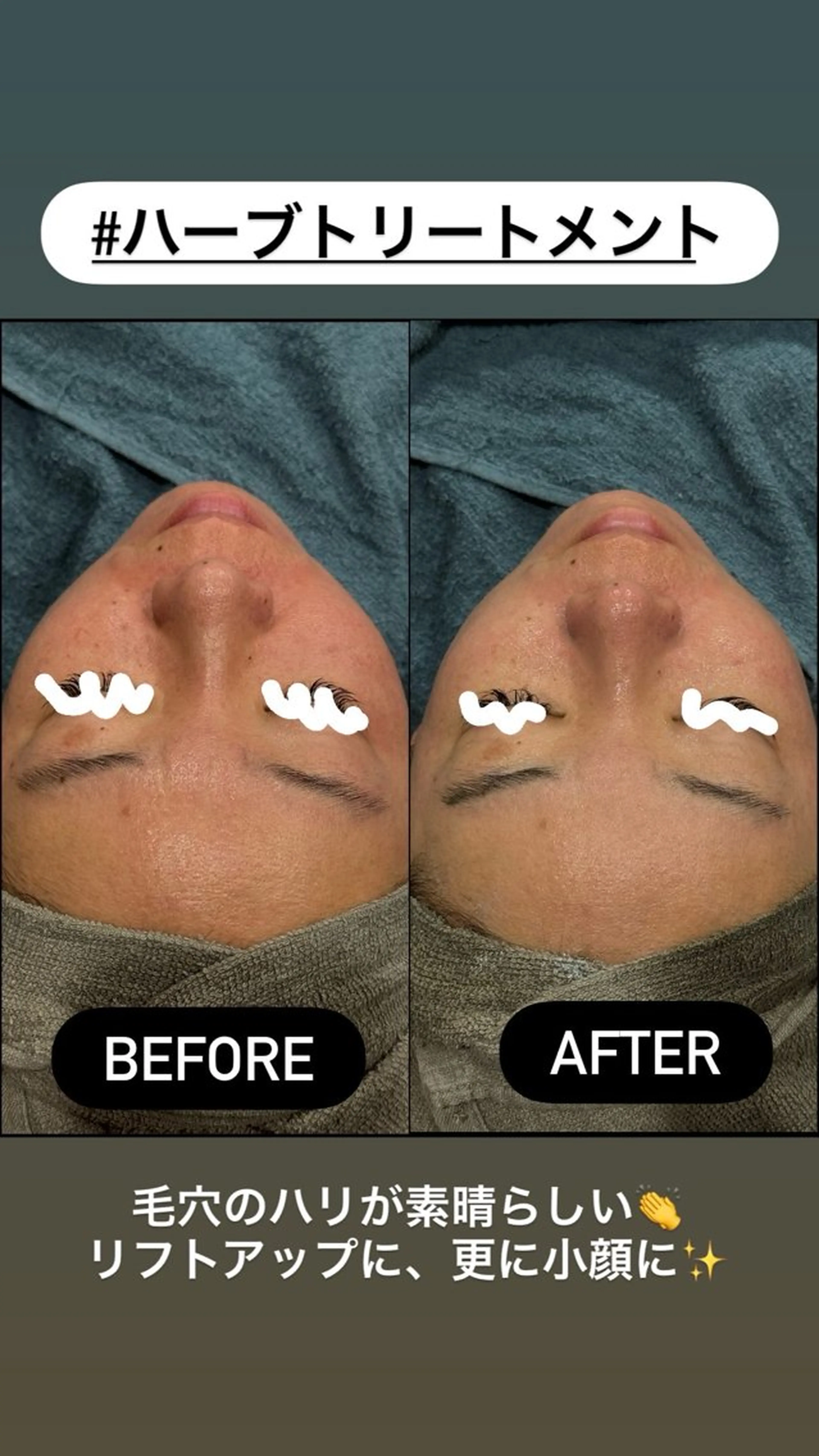 エステ LiZA エステティックサロンのエステ・リラクイメージ