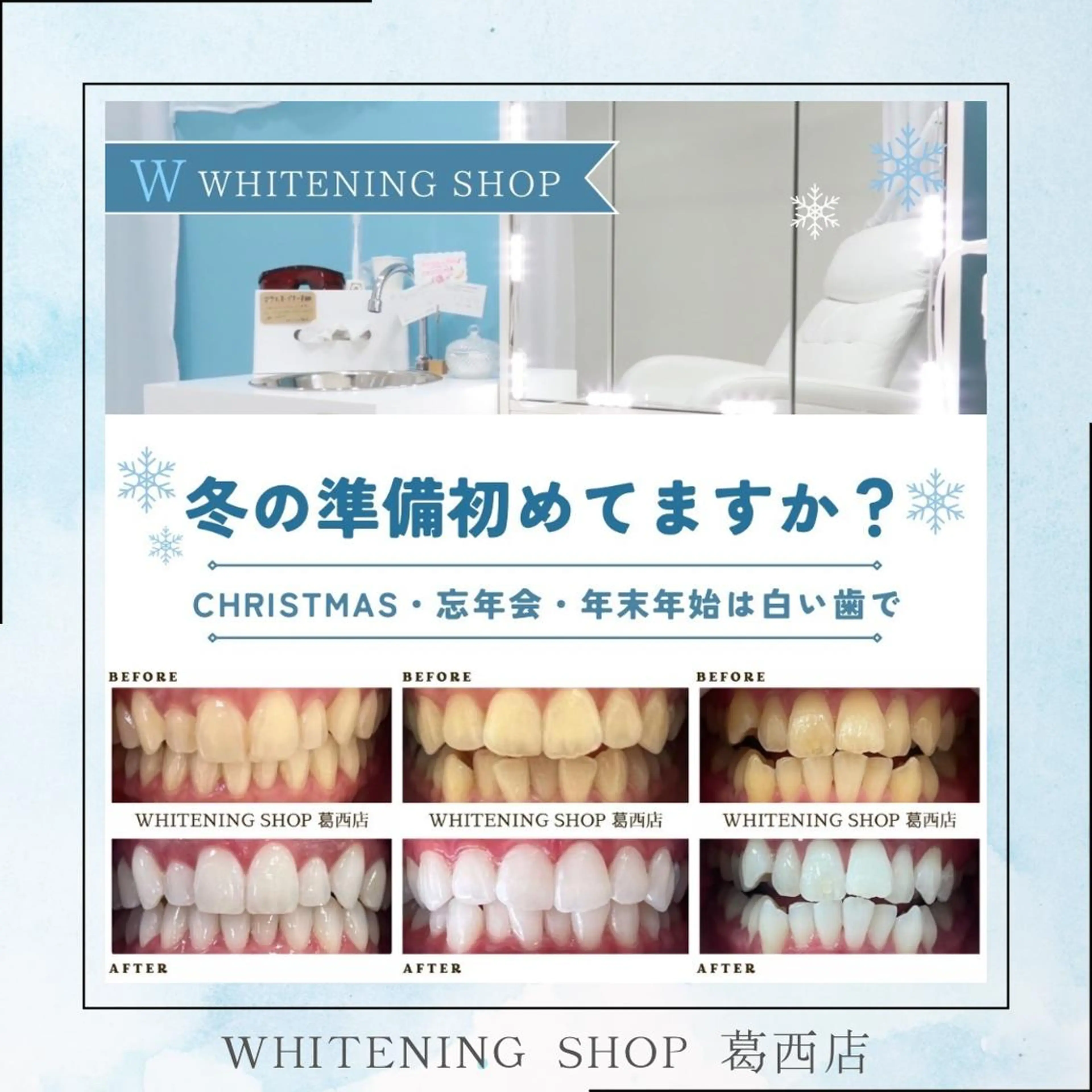 メンズ クリスマス その他 ホワイトニング ショップ葛西店のその他イメージ