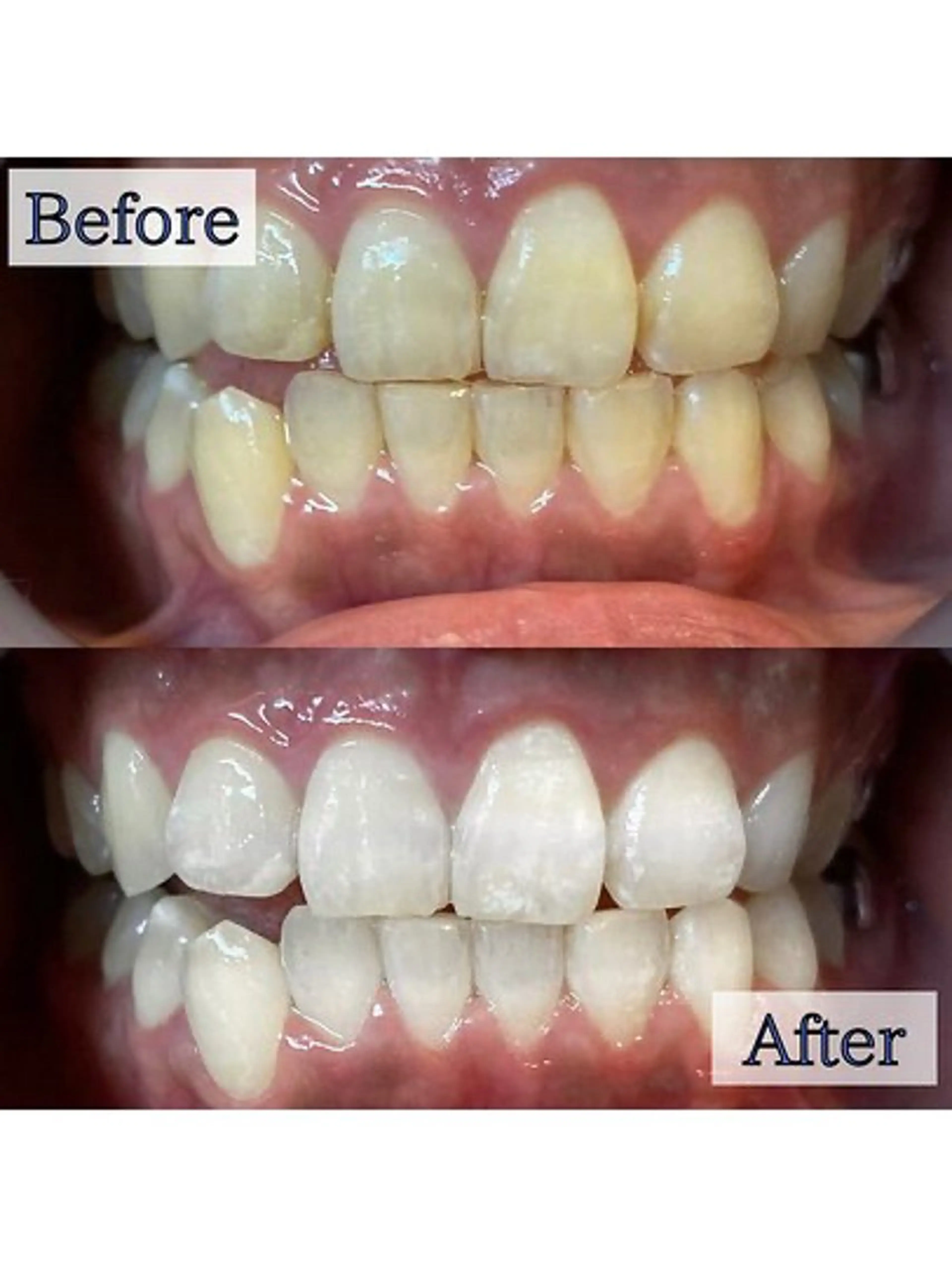 エステ リラク LBSホワイトニング 🌐 上野店公式のエステ・リラクイメージ