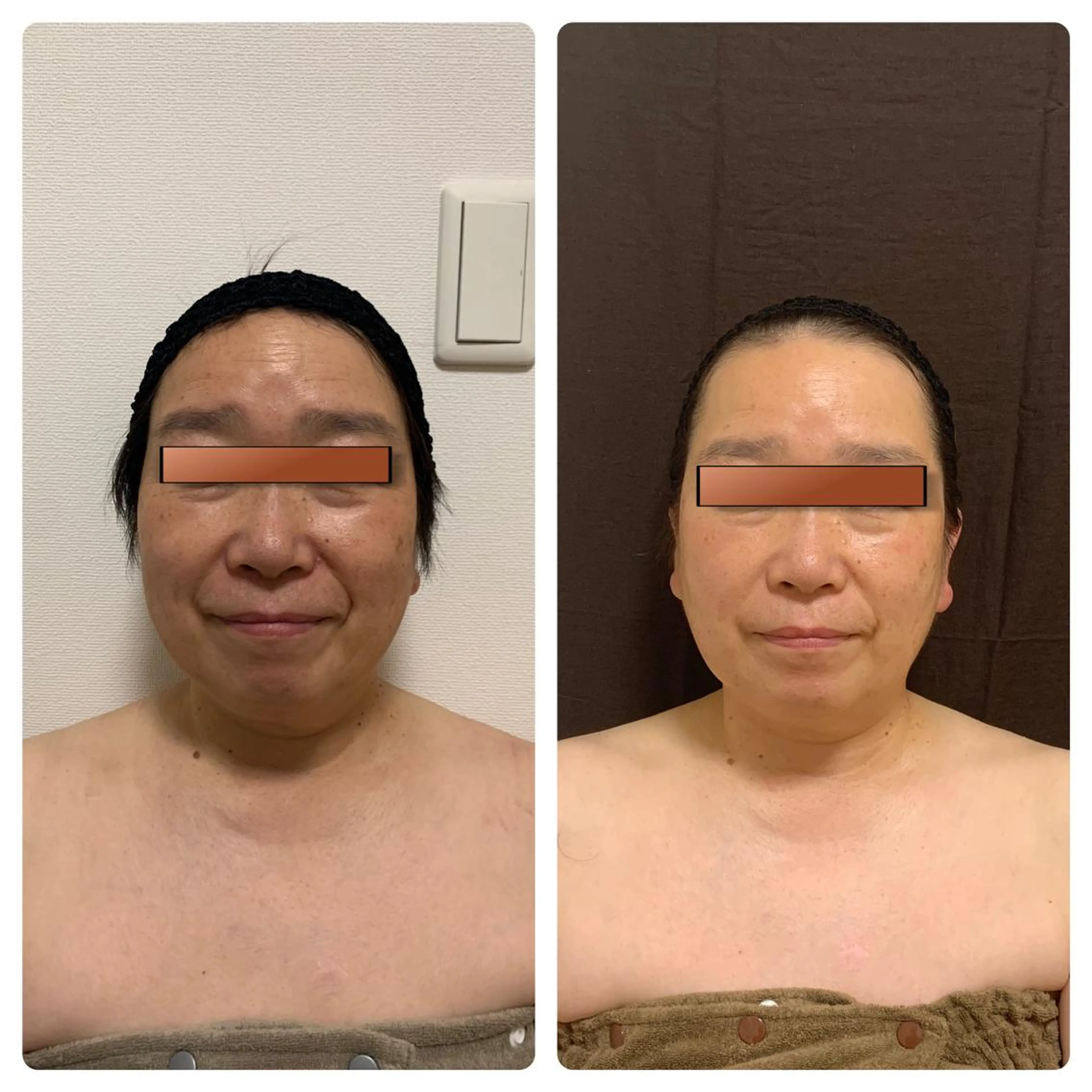 韓国式小顔矯正 担当ゆいのエステ・リラクイメージ