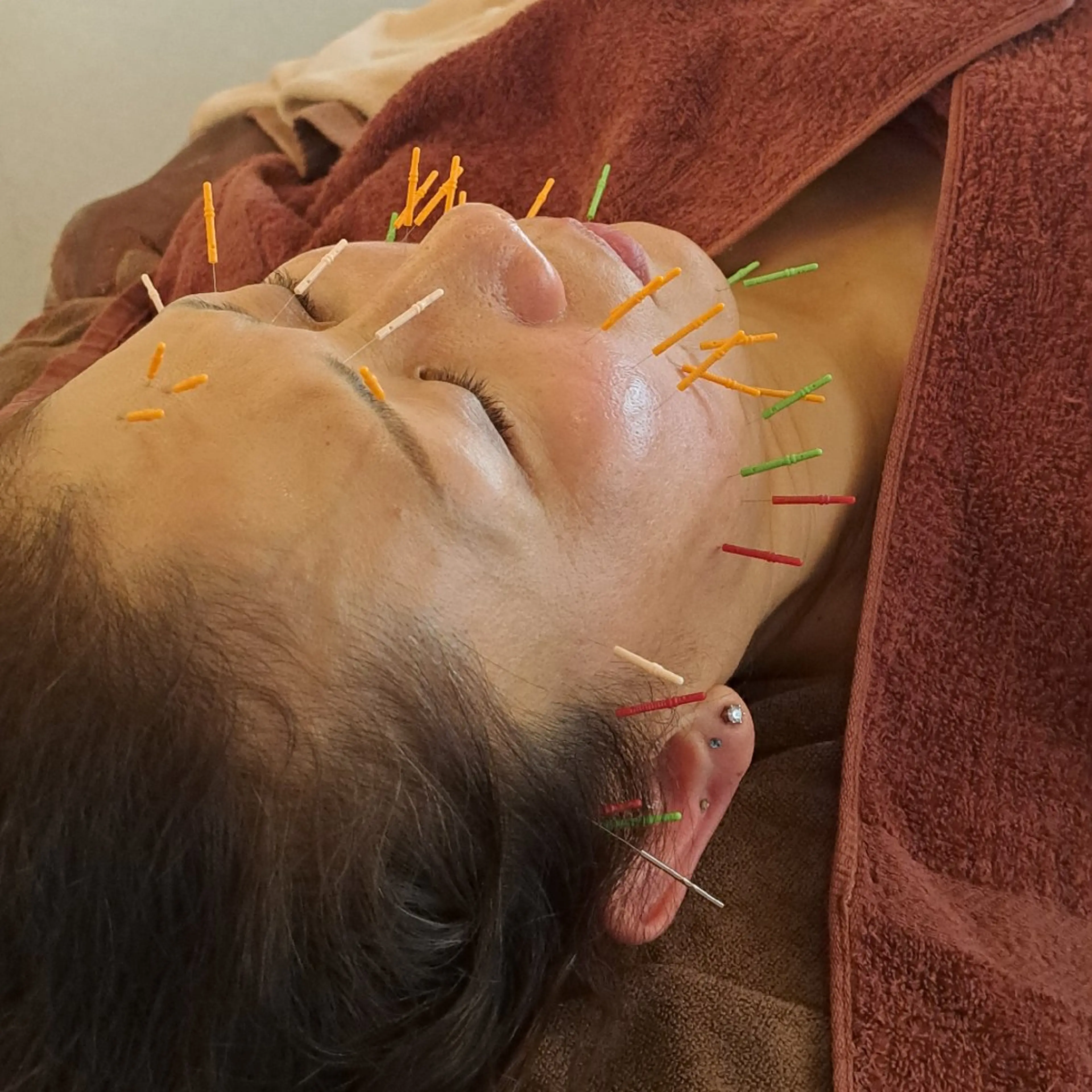 エステ リラク 鍼灸サロンmiyabi所属・美容鍼×エステ　鍼灸 サロンmiyabiのエステ・リラクイメージ