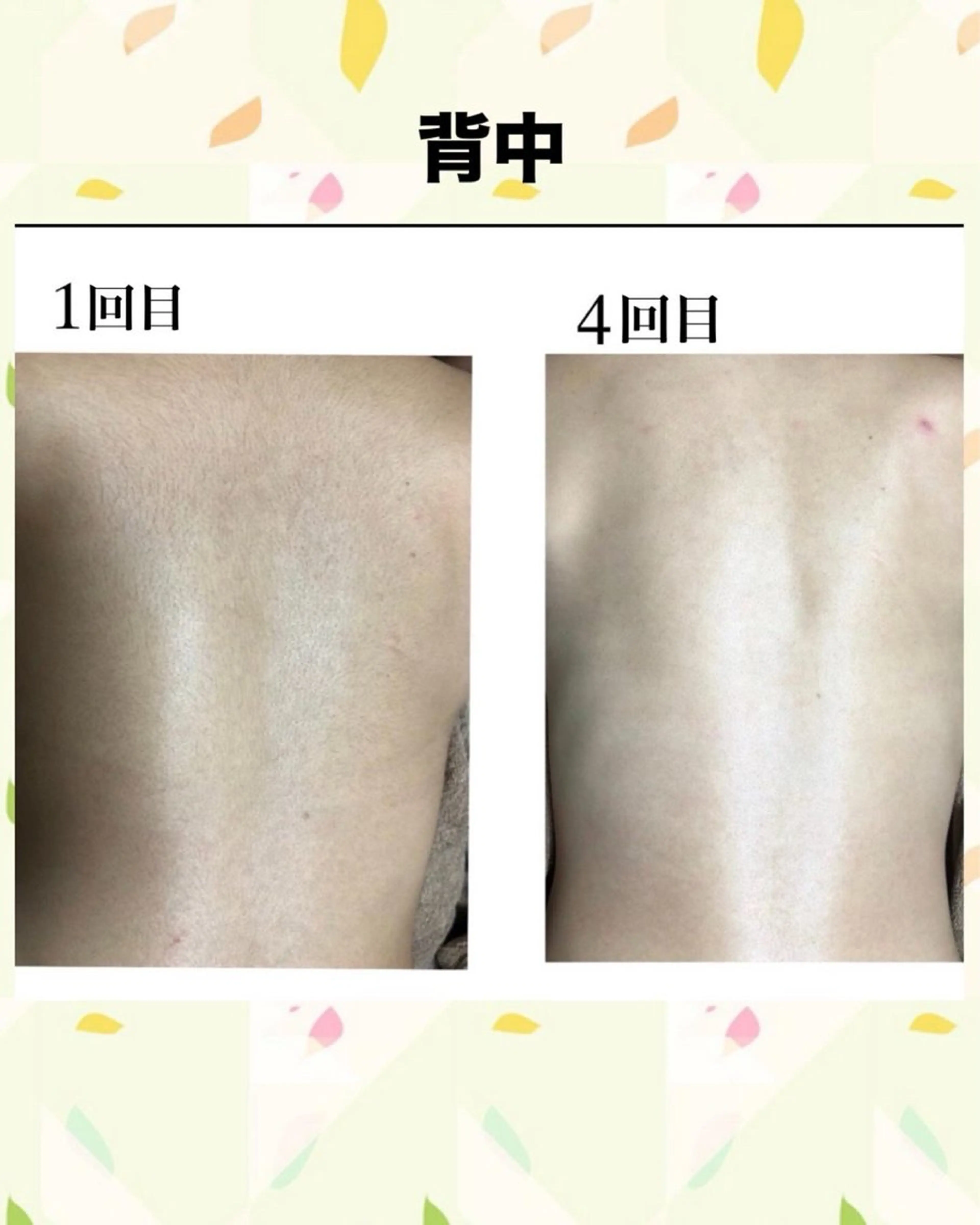 脱毛 Belle ＋vi（ベル）のその他イメージ