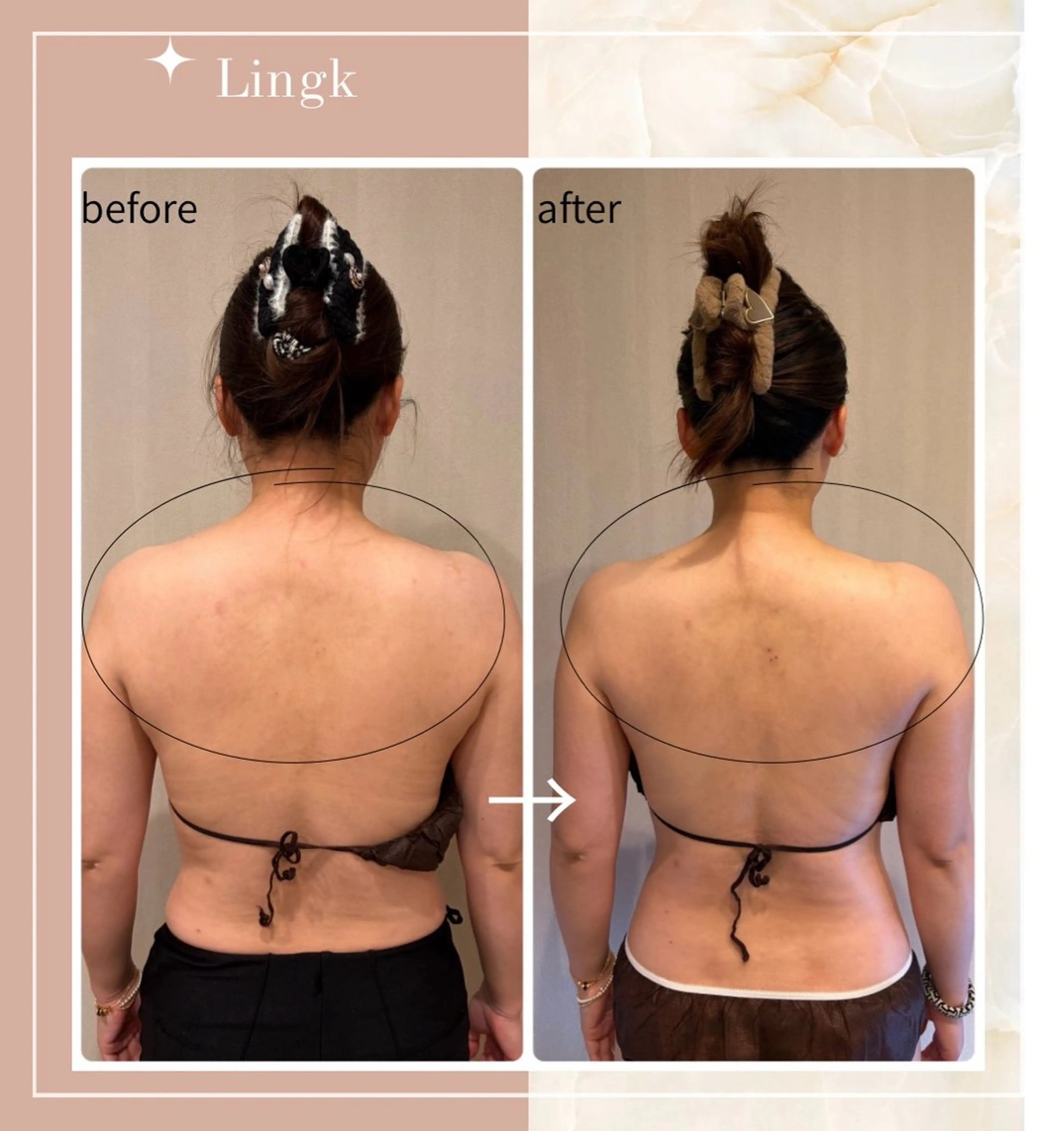 エステ リラク LingK/Este 中松 聖奈のエステ・リラクイメージ