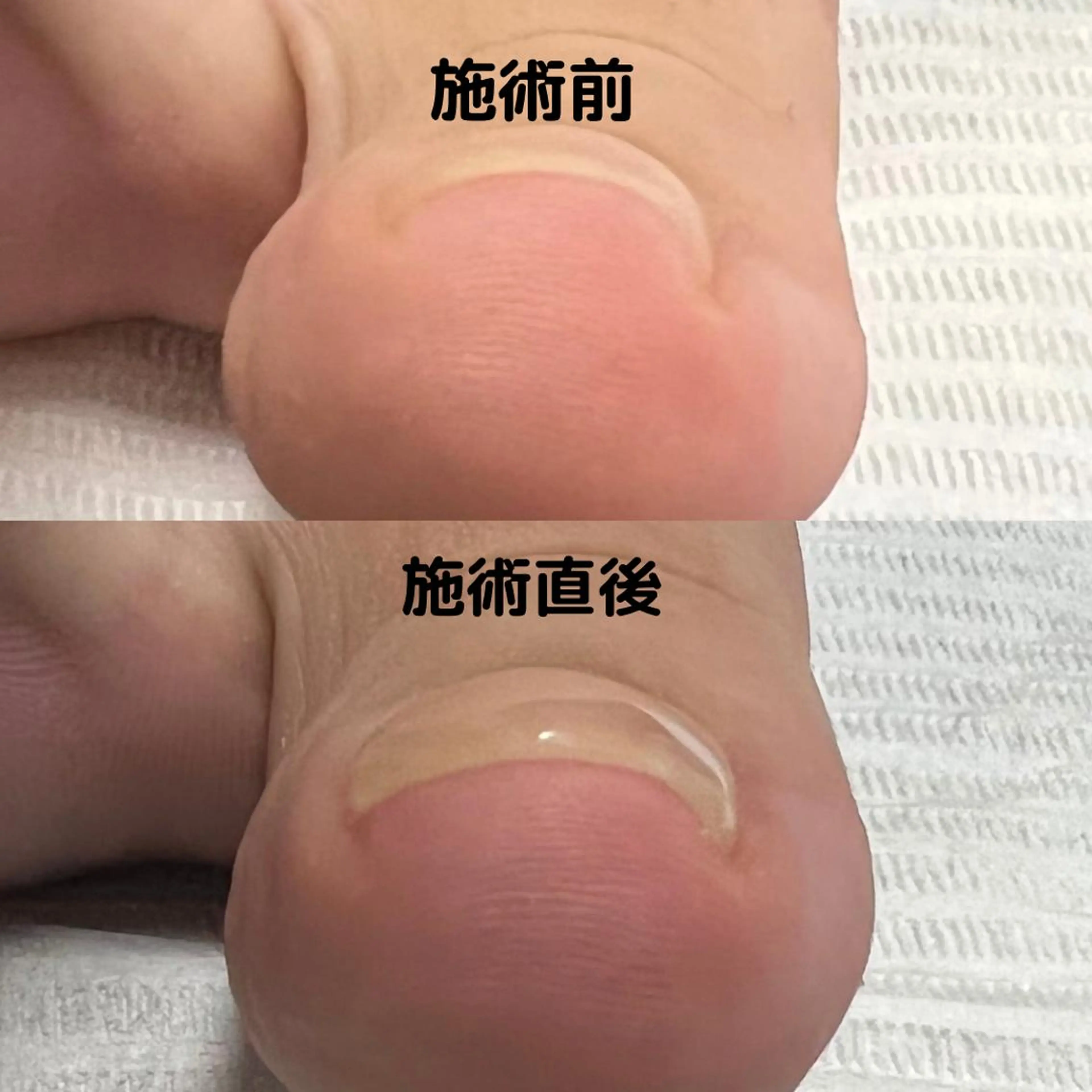 ネイル フットネイル Gatto(ガット) ヤマモトのネイルデザイン