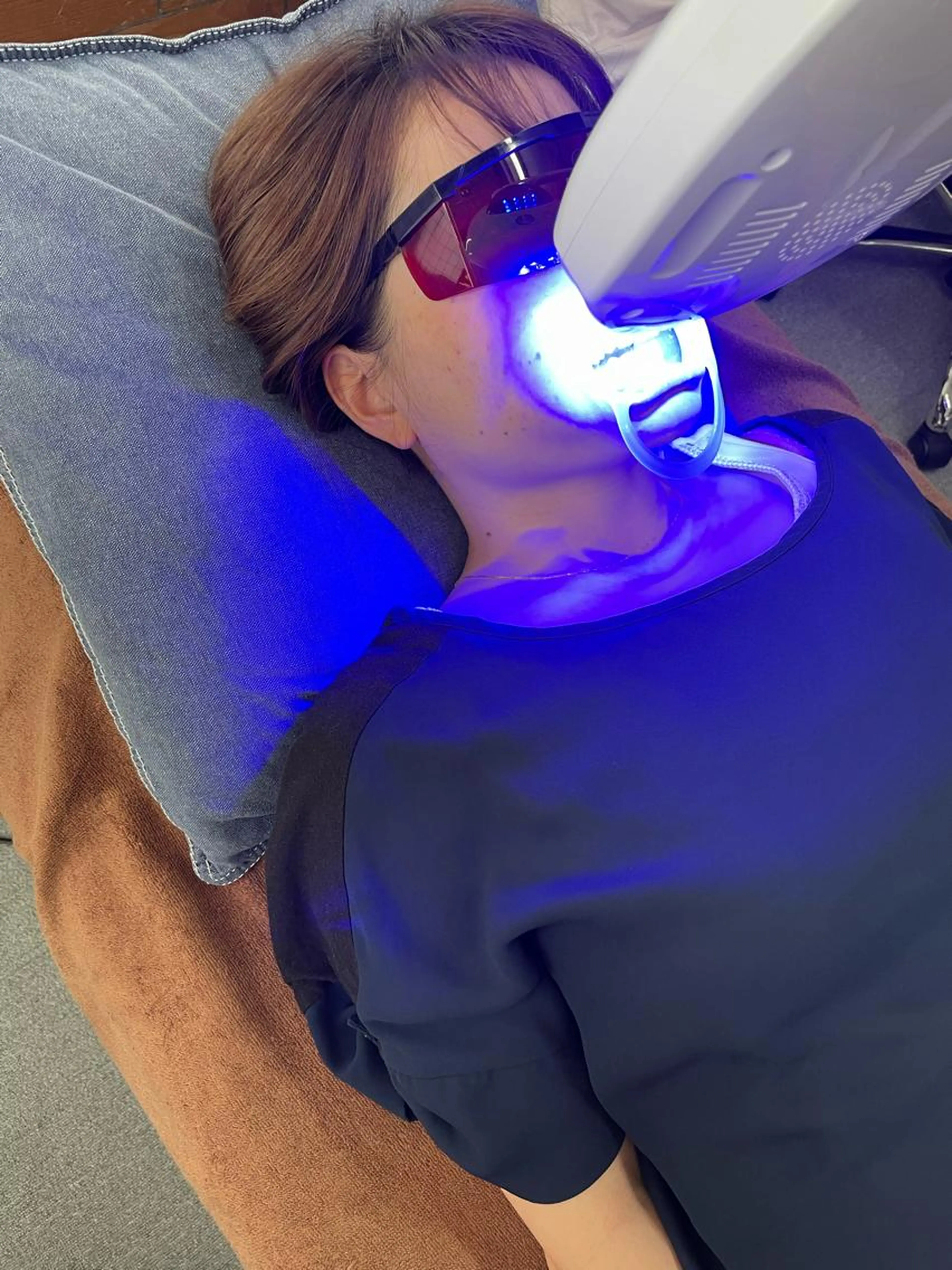 🦷セルフホワイトニング🦷¥4,980→¥2,980期間限定10名様の写真