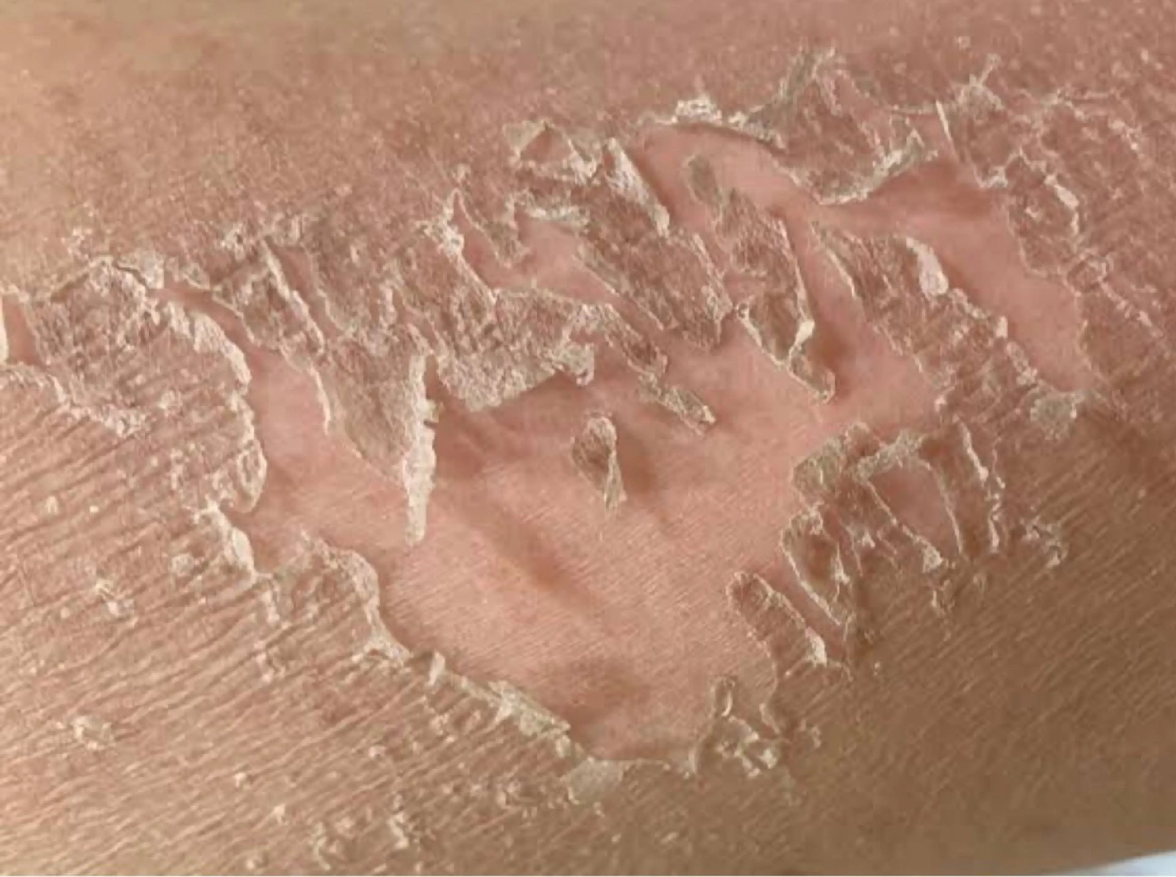 エステ ☺ハーブピール💕 ソフィアカロン💖のエステ・リラクイメージ