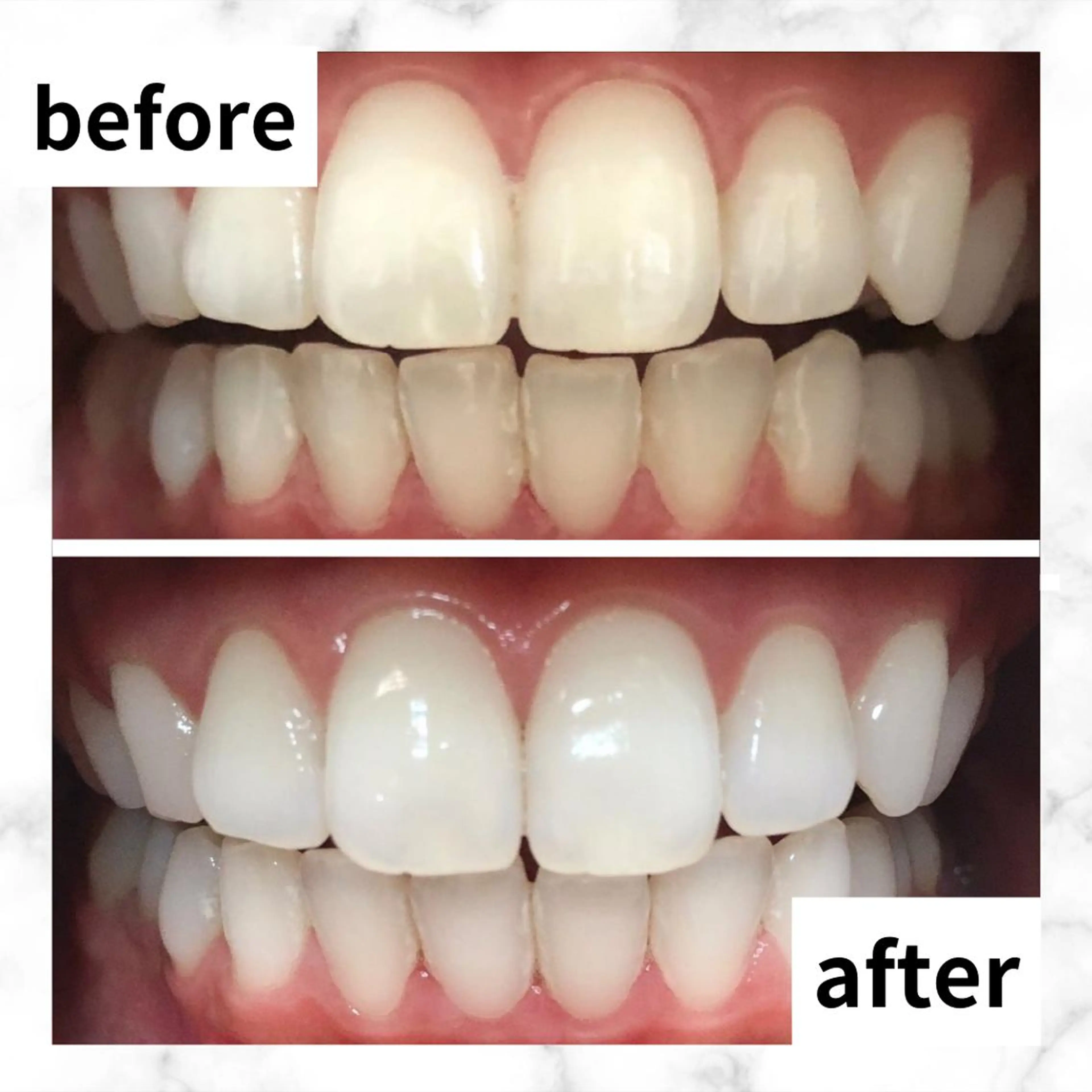 LBSホワイトニング 🌐渋谷店 河内のエステ・リラクイメージ