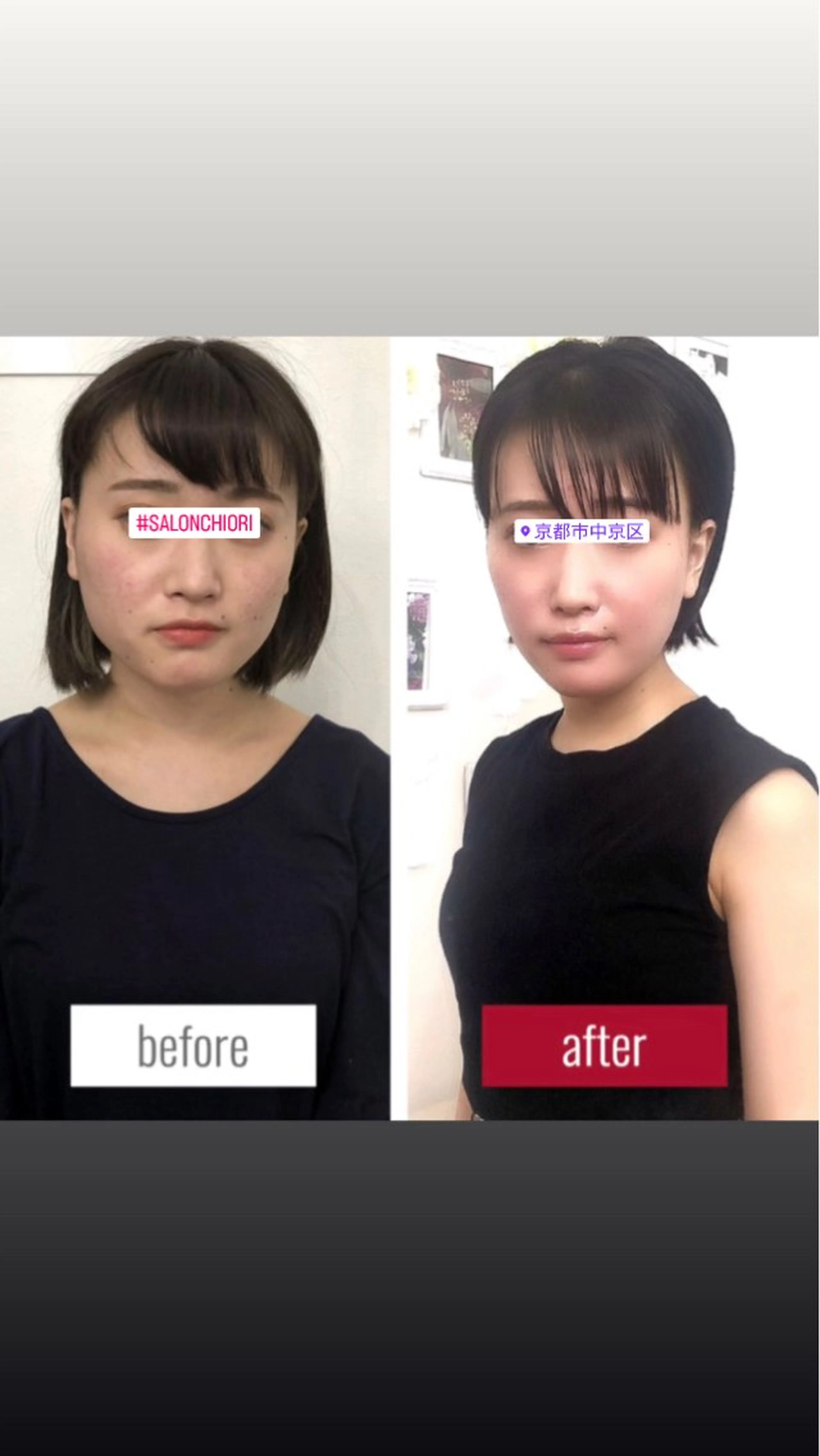 【京都人気No.1】小顔矯正+身体＋姿勢矯正フルセット60分（通常¥19,980】の写真