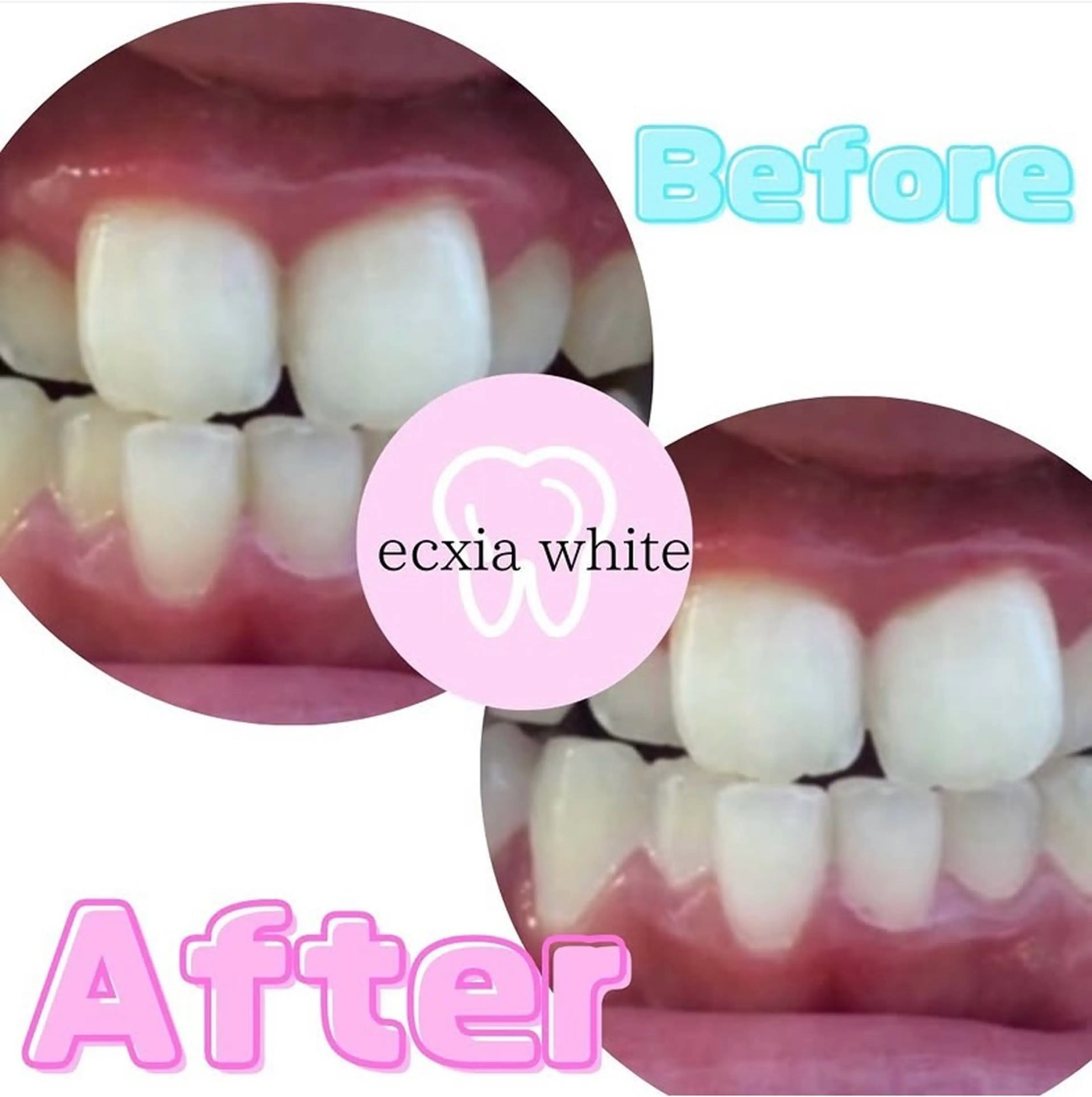 nanami -ホワイトニングのその他イメージ